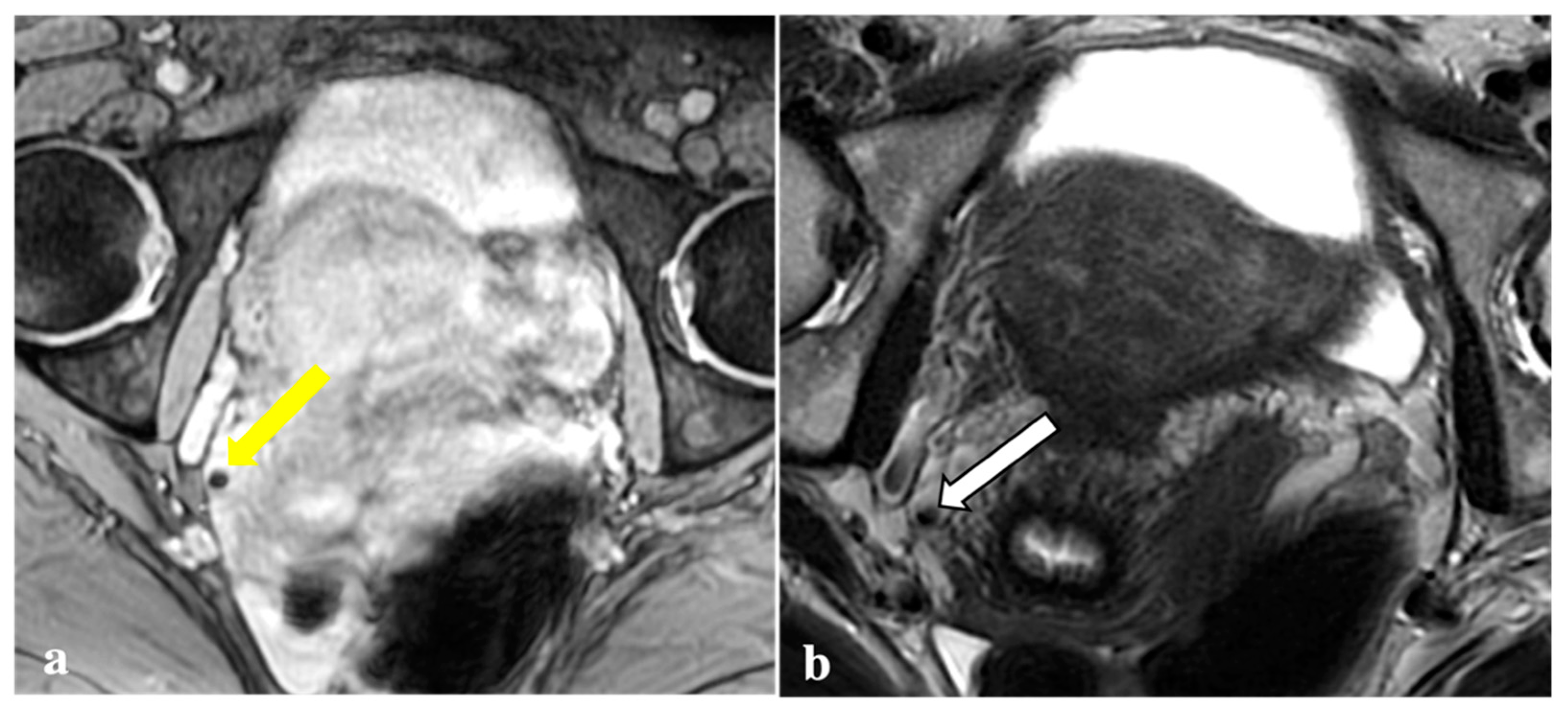 Diagnostics 12 01545 g005 550