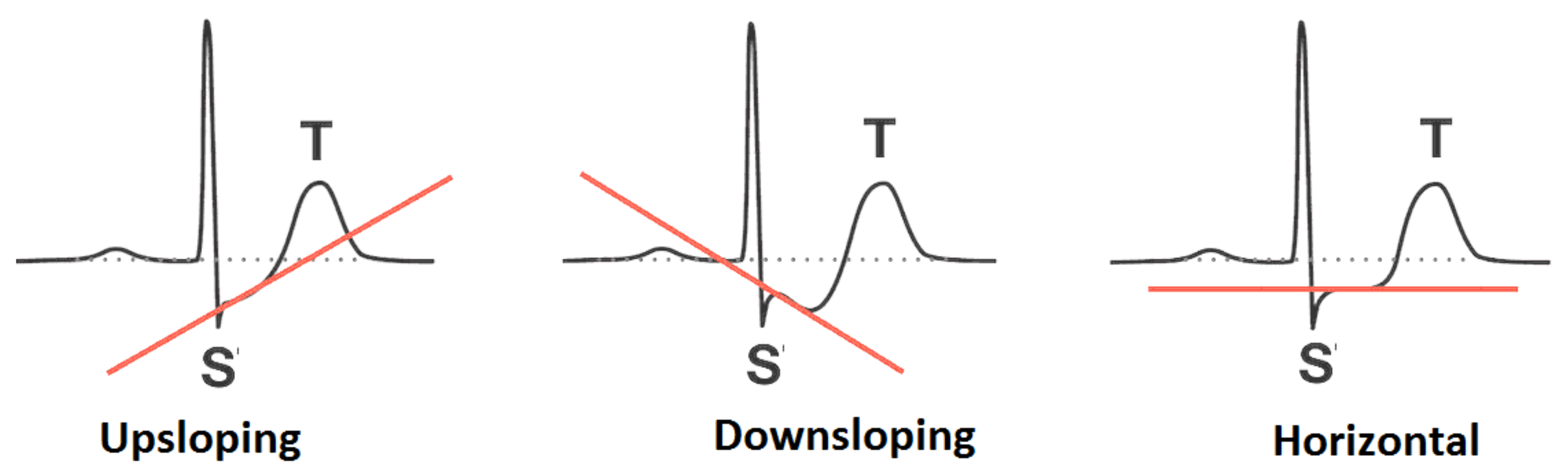 Diagnostics 12 01546 g005