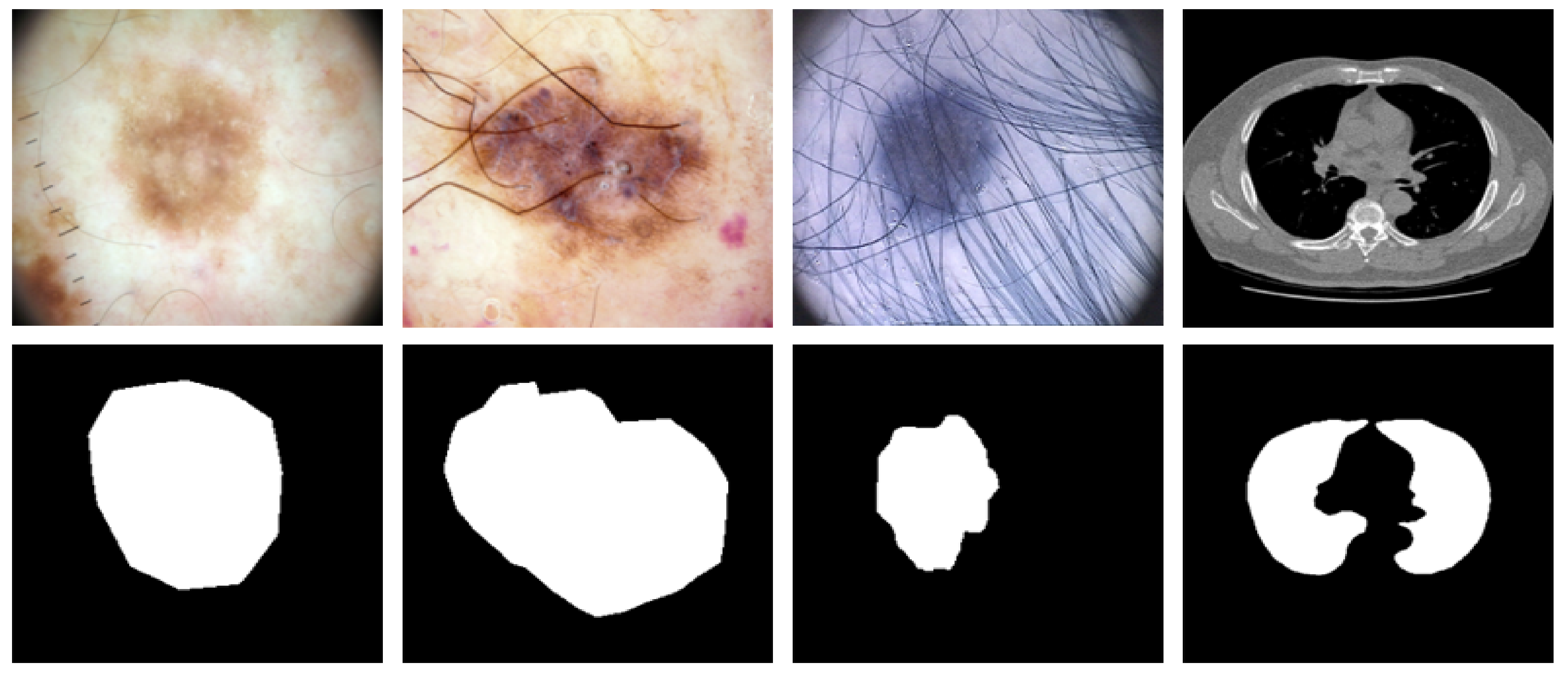 Diagnostics | Free Full-Text | Medical Image Segmentation with Learning ...