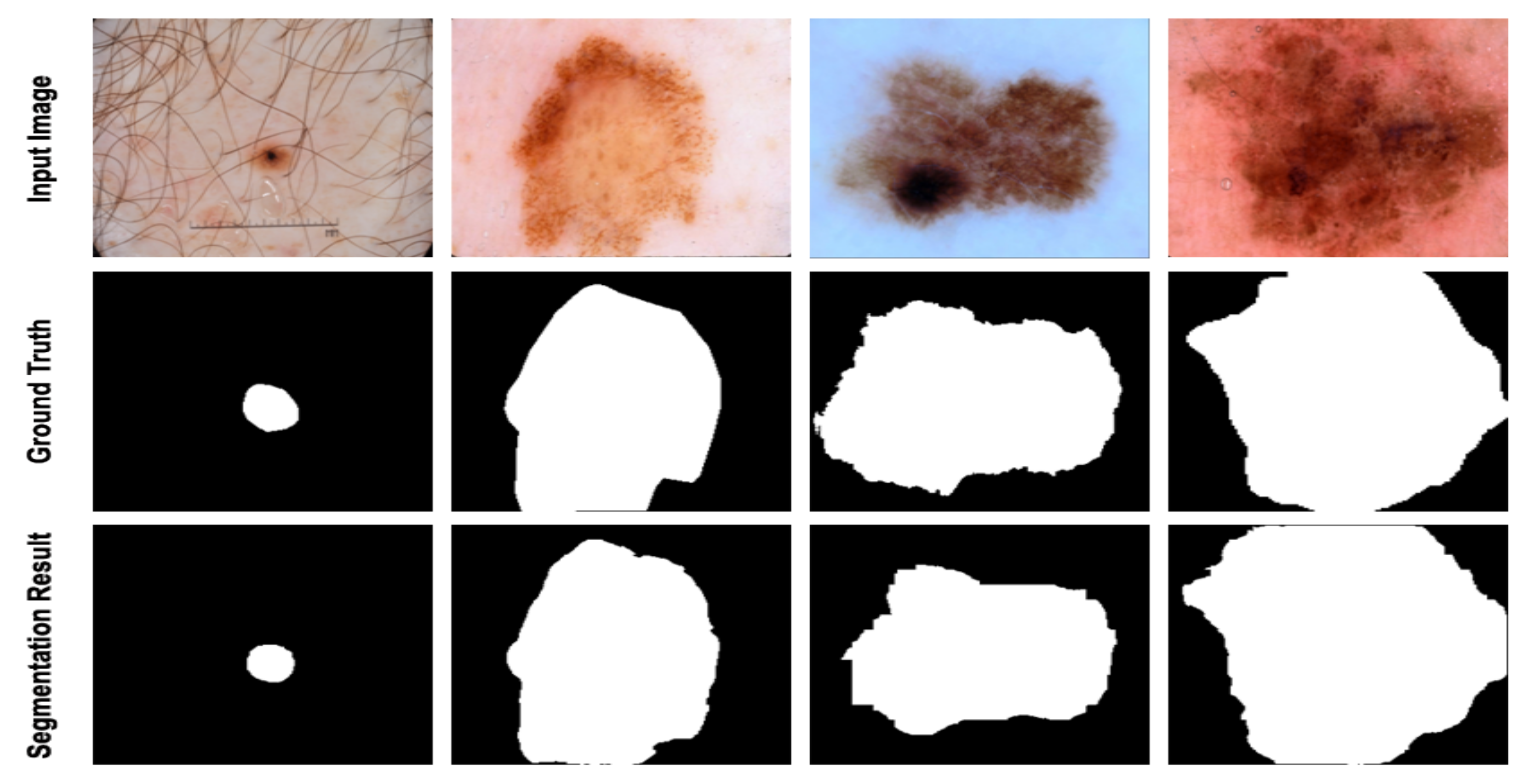 Diagnostics | Free Full-Text | Medical Image Segmentation with Learning ...