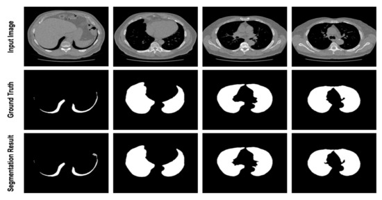 Diagnostics | Free Full-Text | Medical Image Segmentation with Learning ...