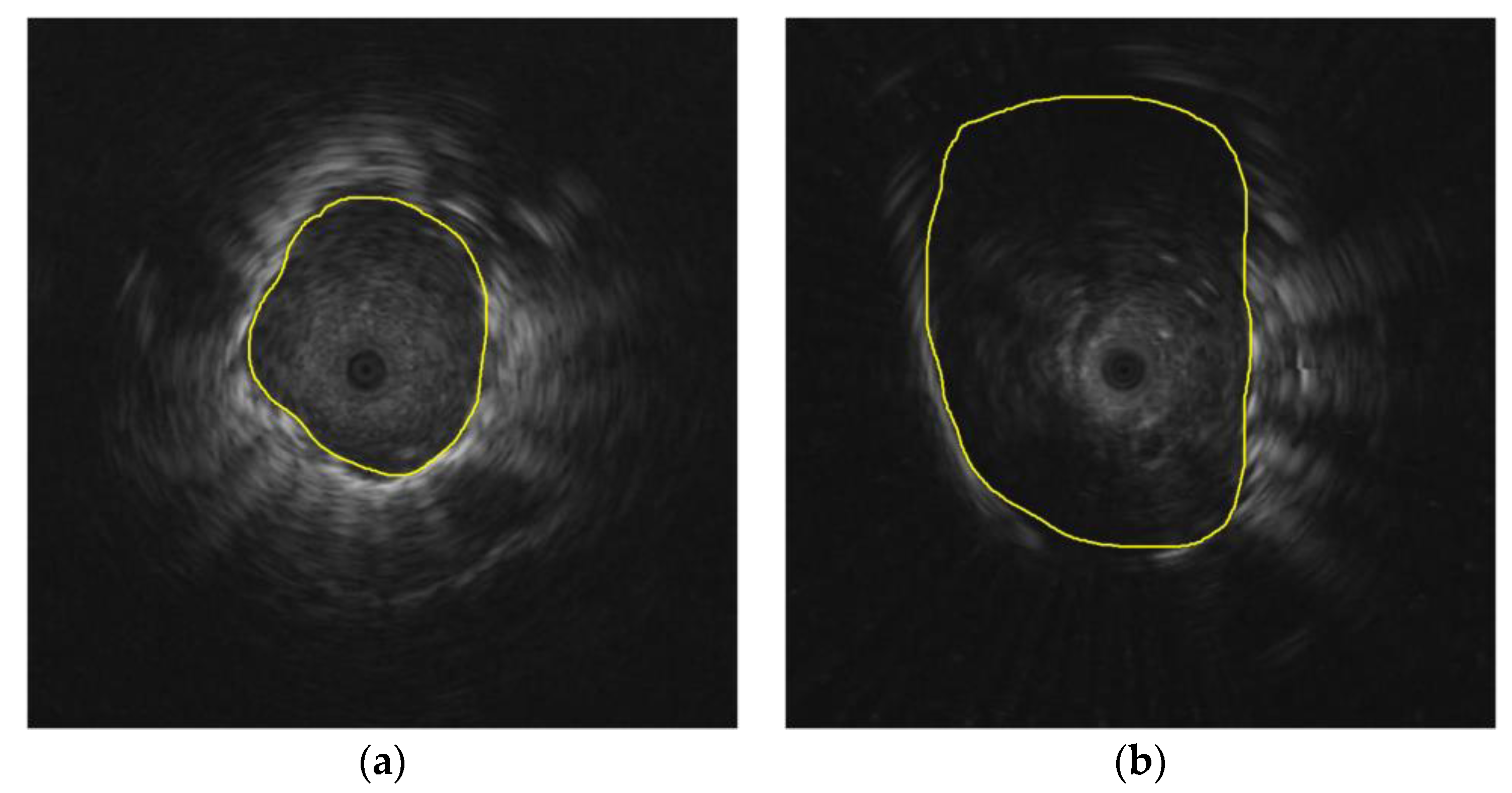 Diagnostics 12 01552 g014 550