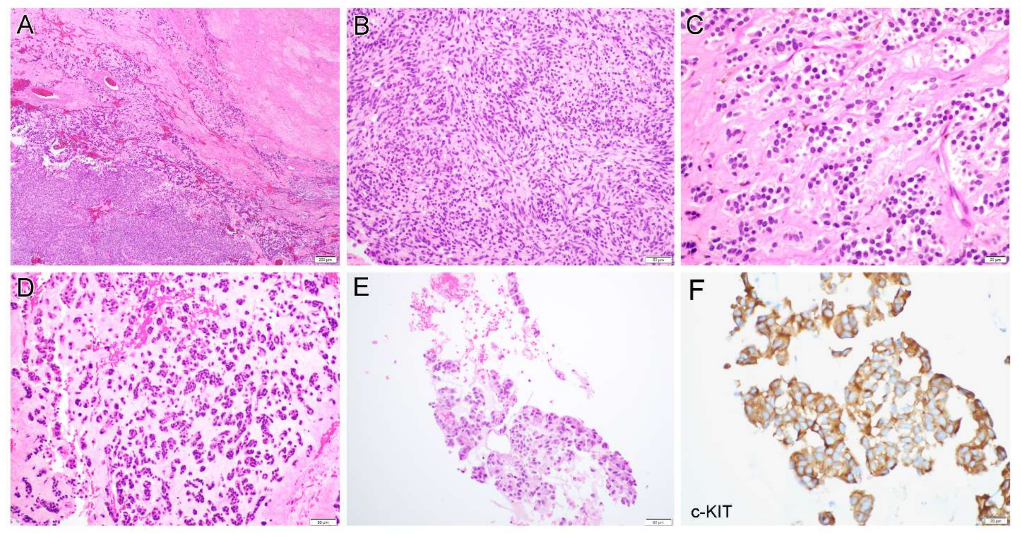 Diagnostics 12 01563 g004a