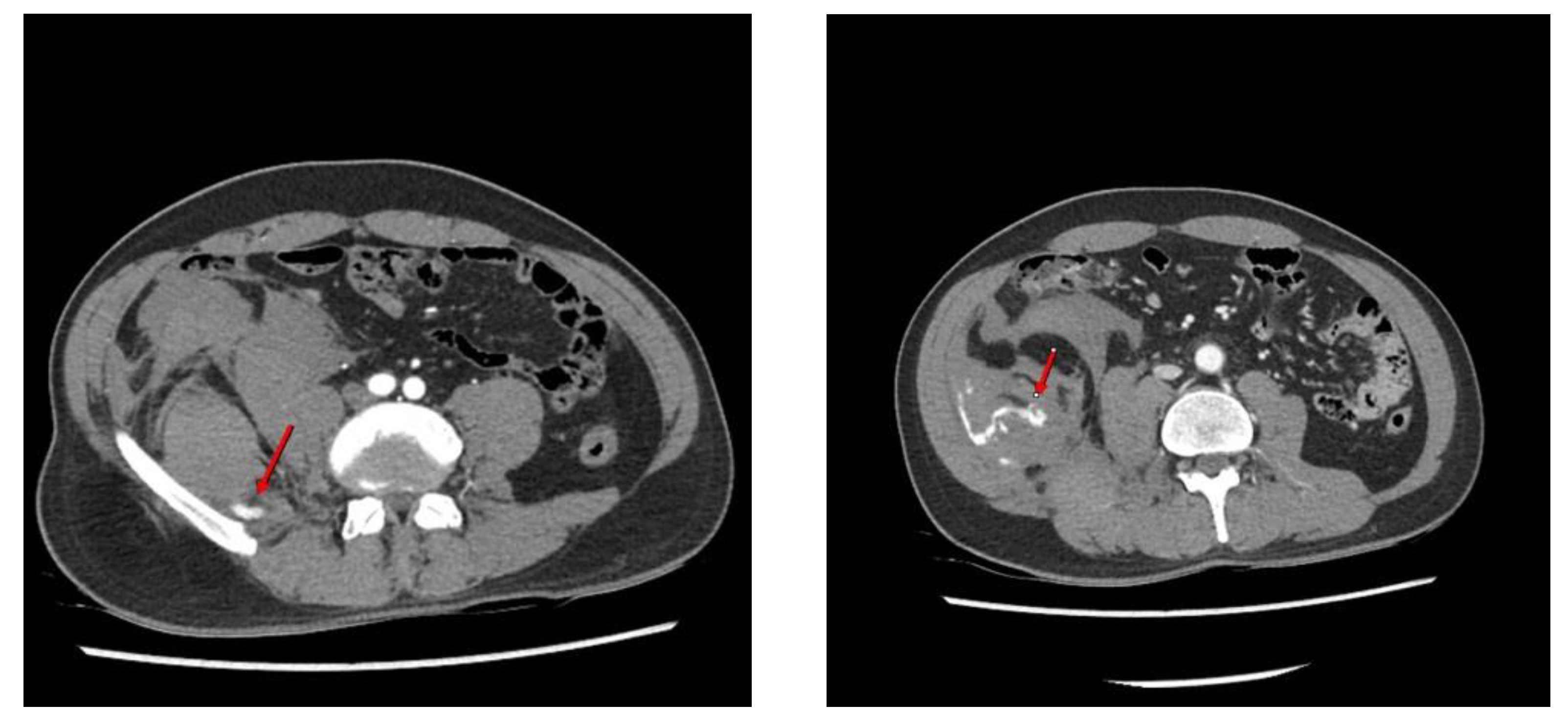 Diagnostics 12 01568 g001 550