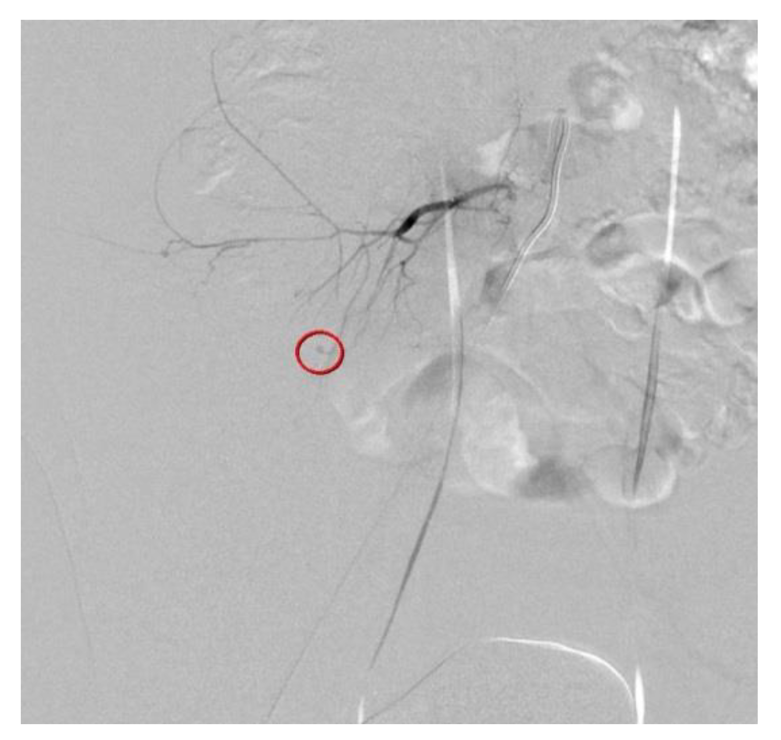 Diagnostics 12 01568 g002 550