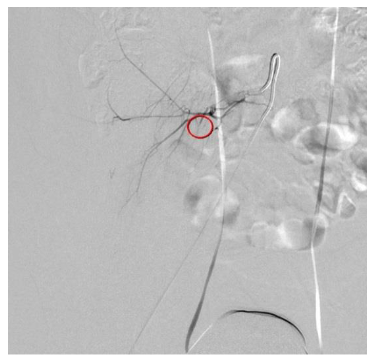 Diagnostics 12 01568 g003 550