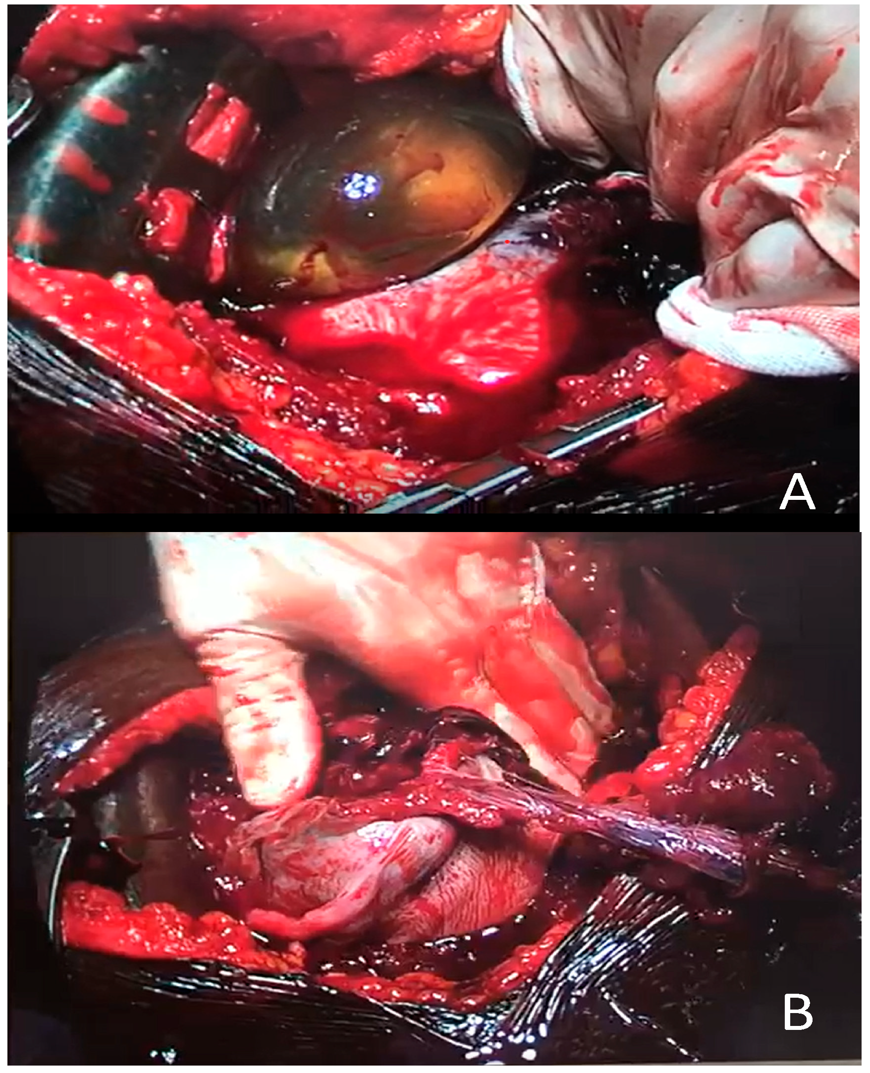 Diagnostics 12 01574 g002 Diagnostics 12 01574 g002