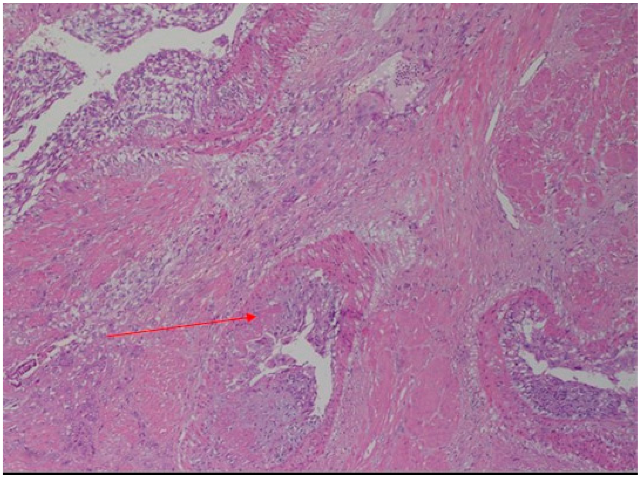 Diagnostics 12 01574 g003 Diagnostics 12 01574 g003