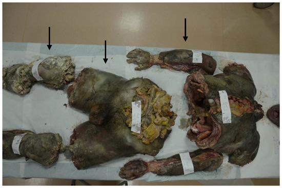 the-role-of-forensic-investigation-in-an-unusual-case-of-patricide-by-a