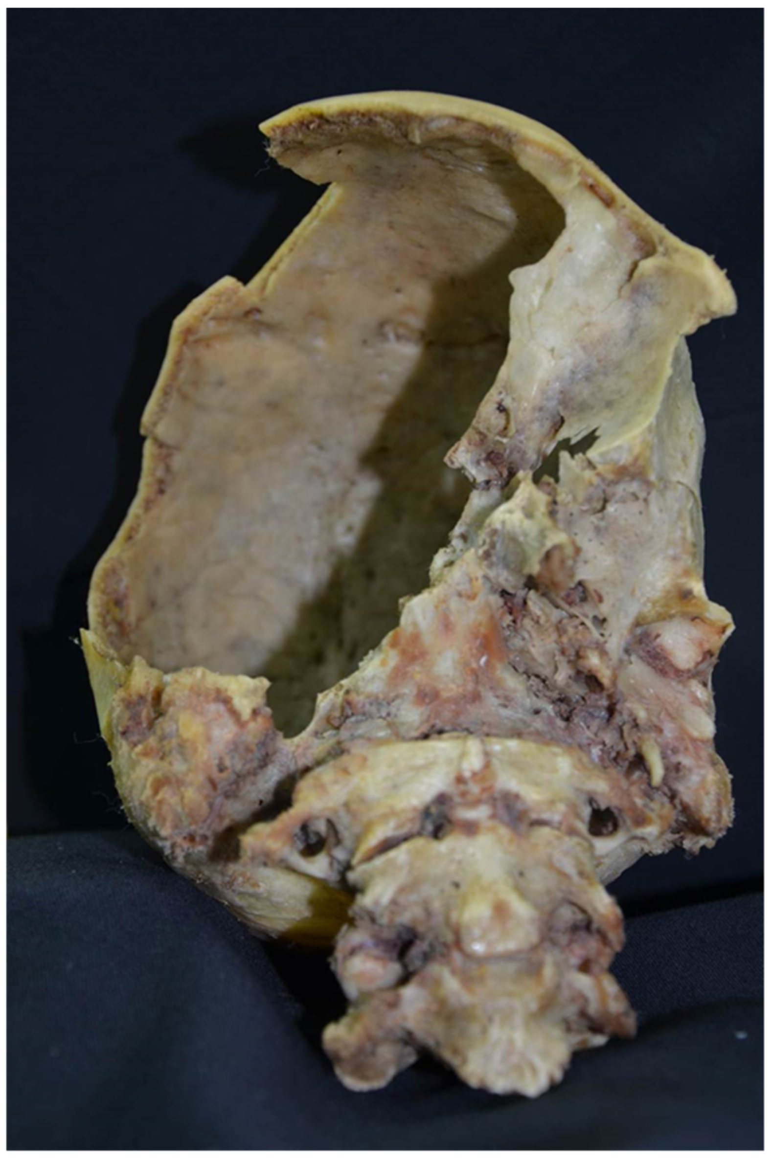 Diagnostics 12 01577 g003 550