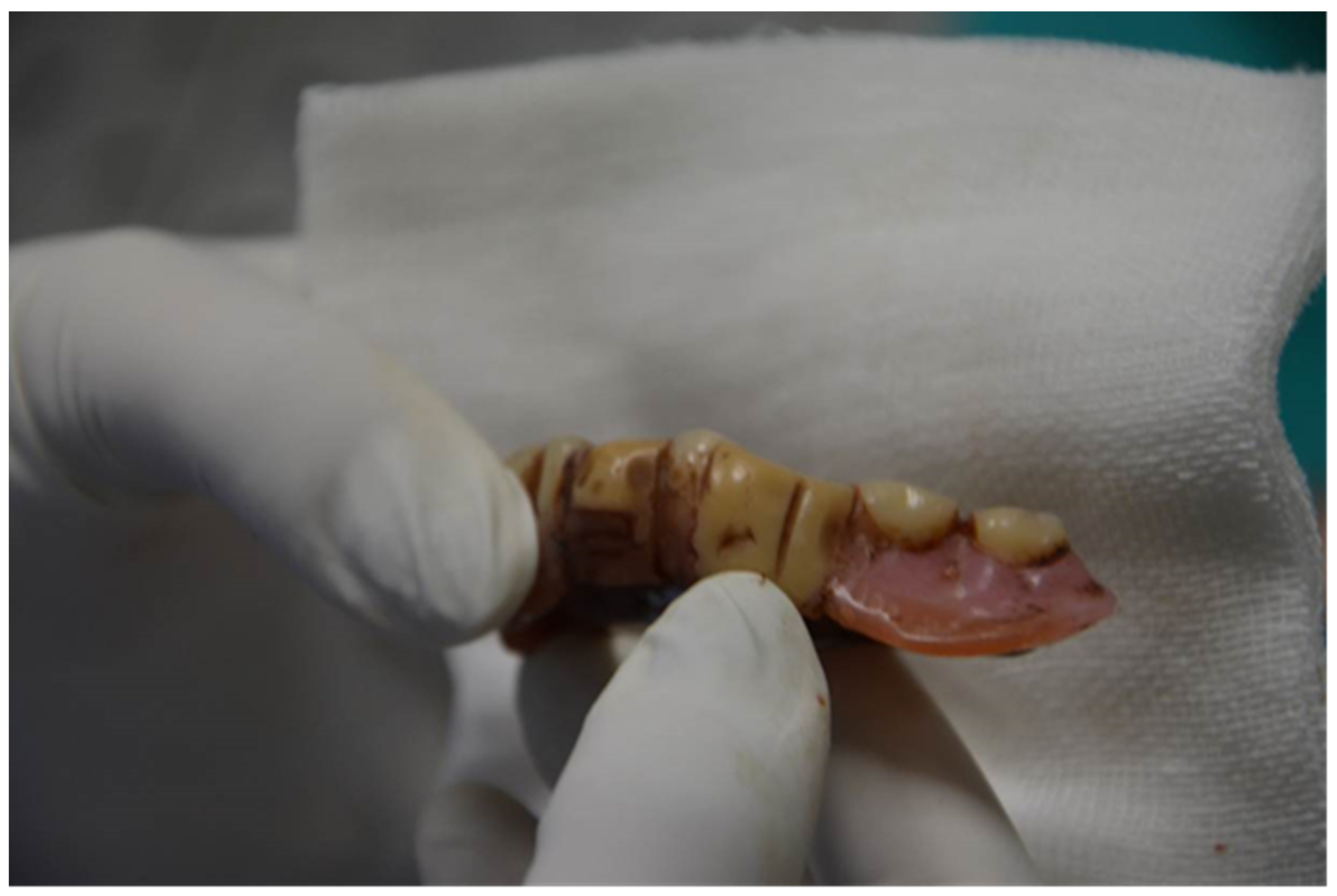 Diagnostics 12 01577 g004 550