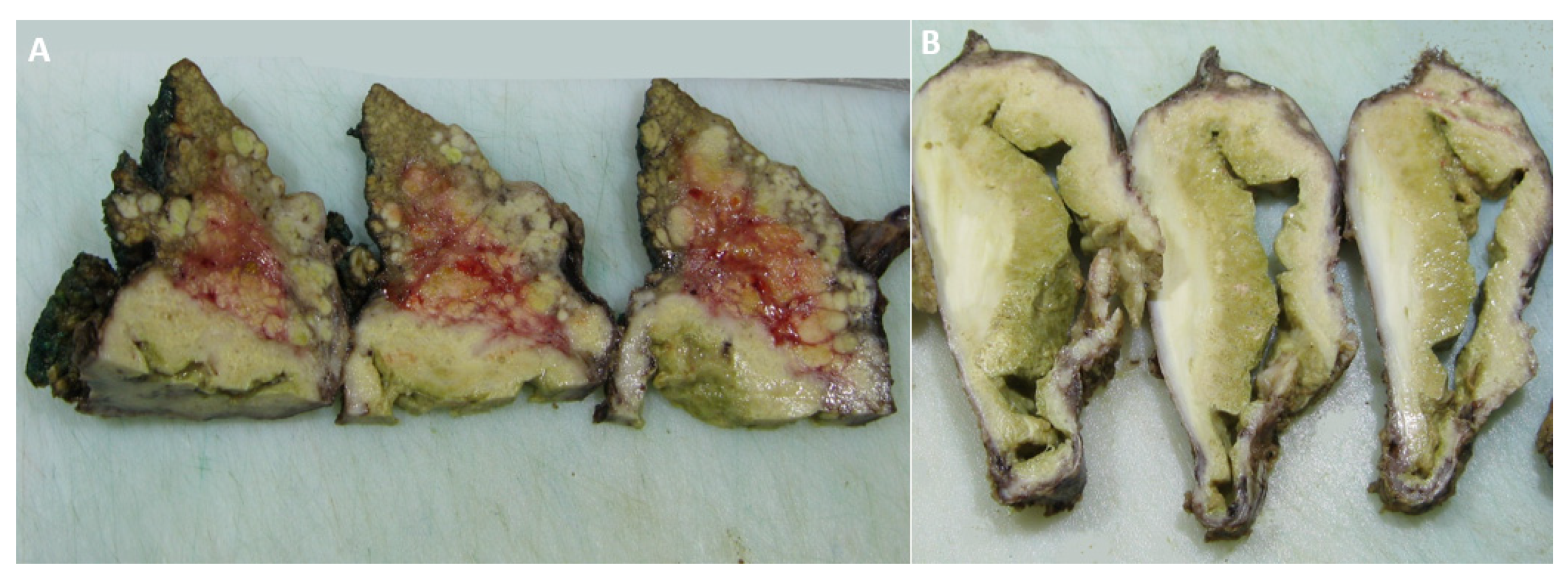 Diagnostics 12 01583 g004