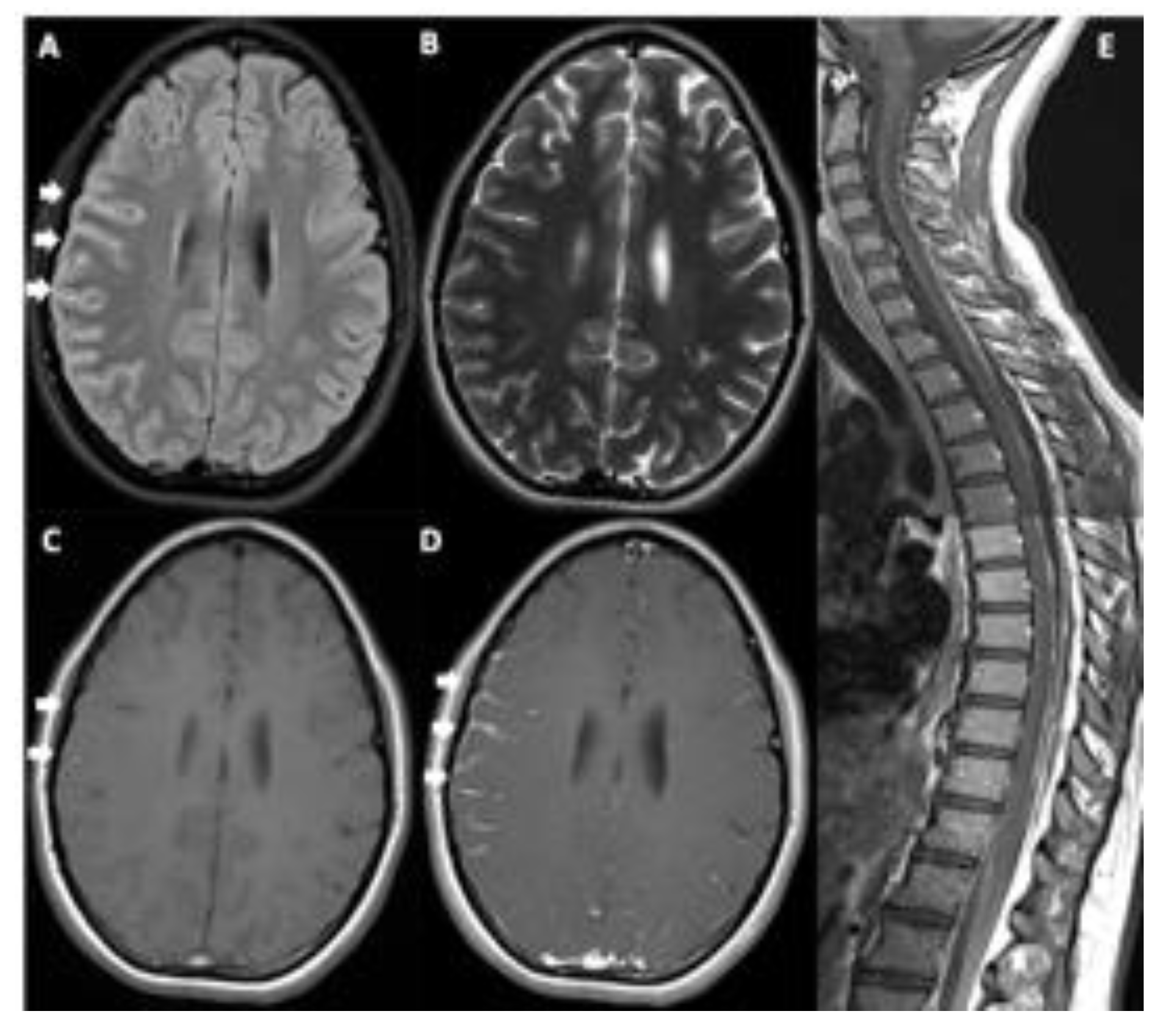 Localization in Clinical Neurology by Paul W. Brazis, Joseph