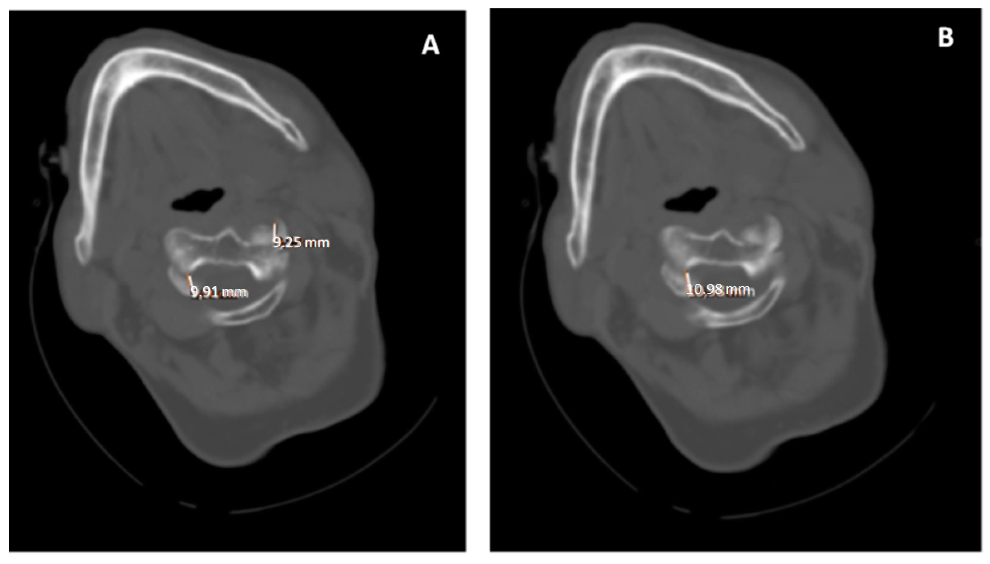 Diagnostics 12 01615 g003 550