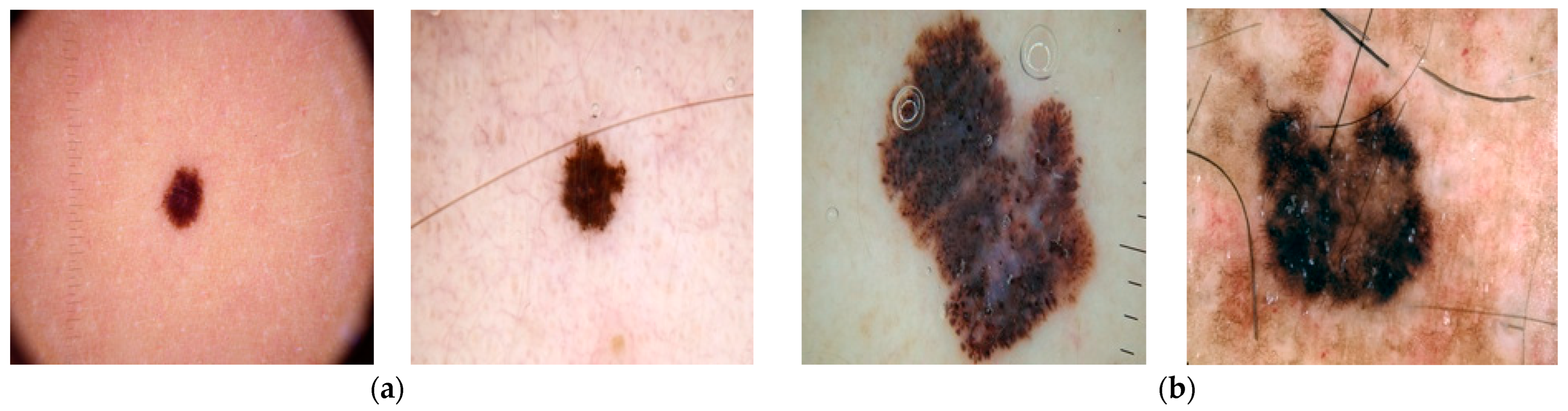 Diagnostics 12 01628 g002 550