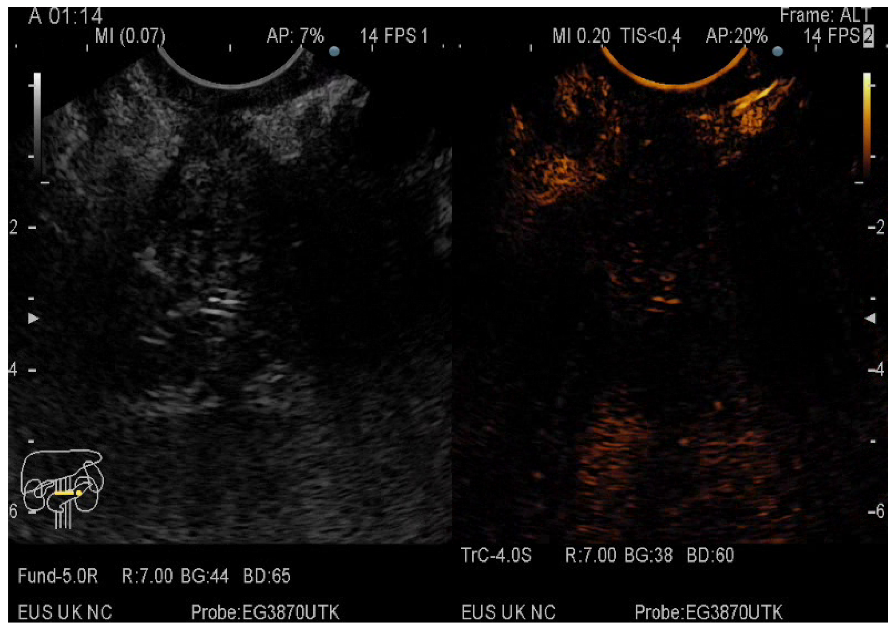 Diagnostics 12 01641 g003