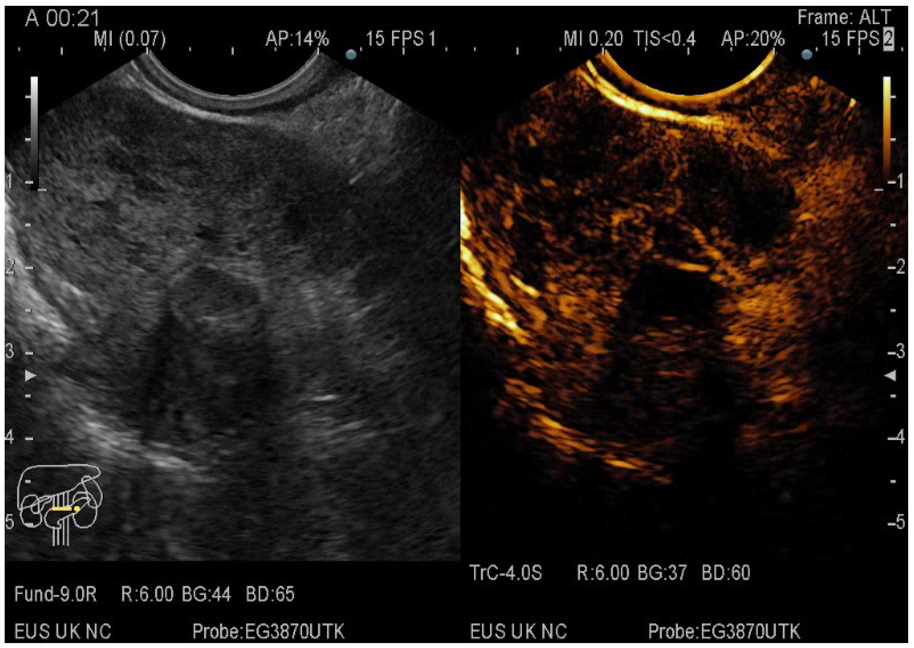 Diagnostics 12 01641 g006