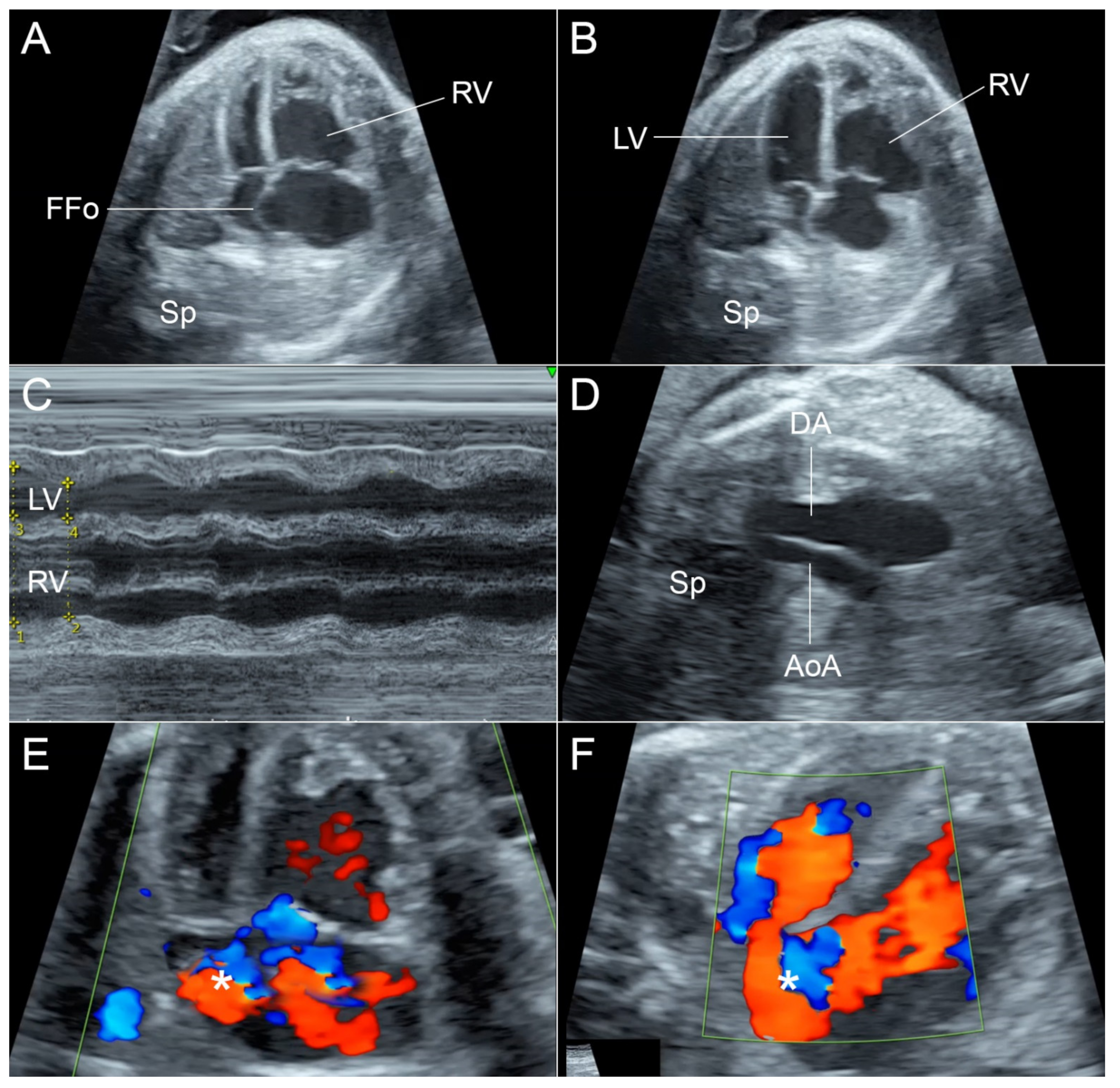 Diagnostics 12 01646 g001 550