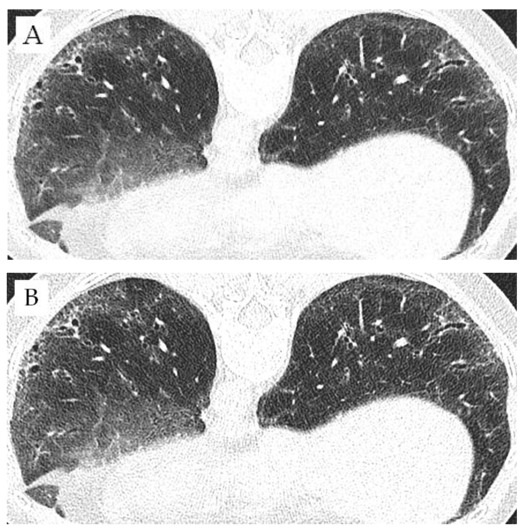 Diagnostics 12 01662 g004 550