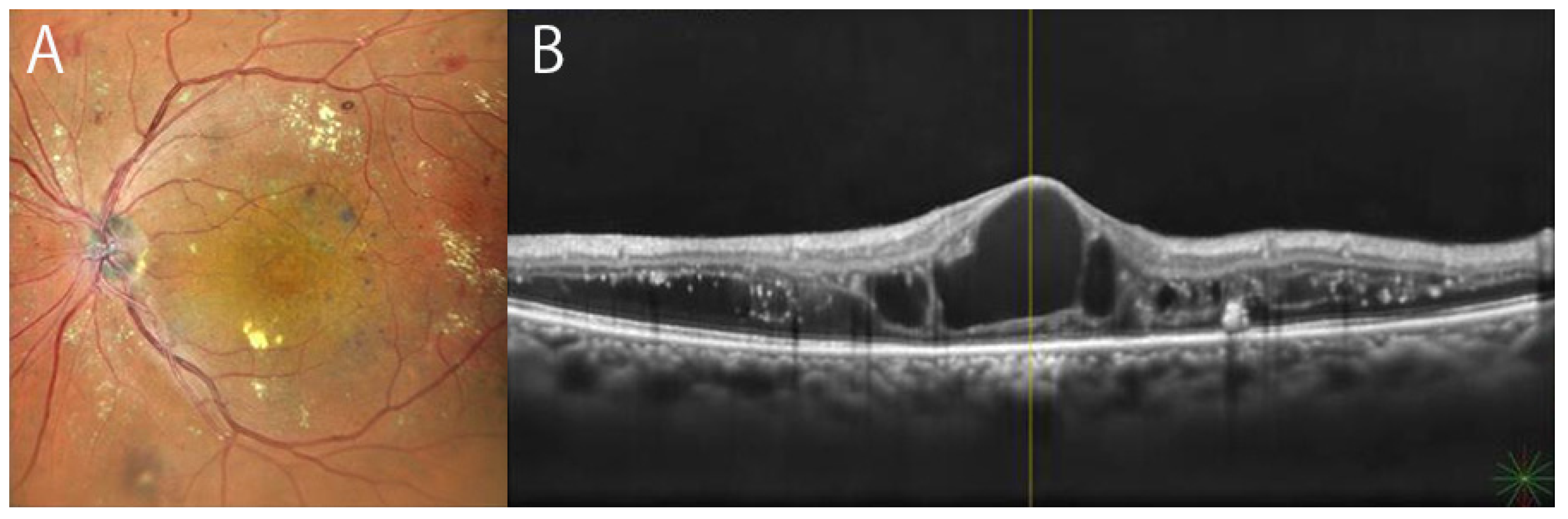 Diagnostics 12 01684 g002 550