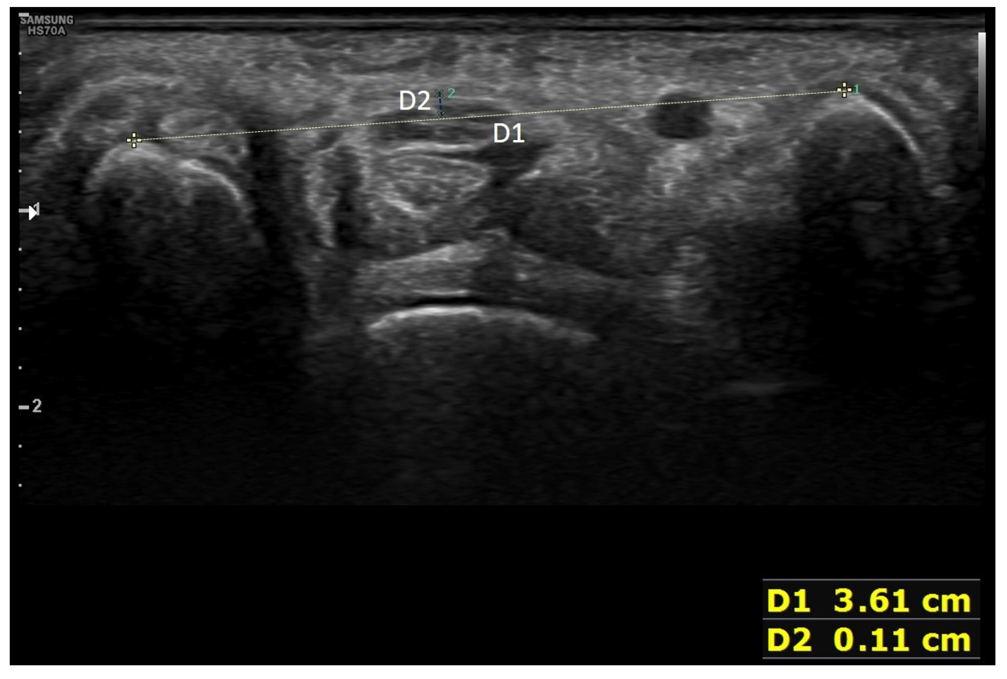 Diagnostics 12 01707 g002 Diagnostics 12 01707 g002
