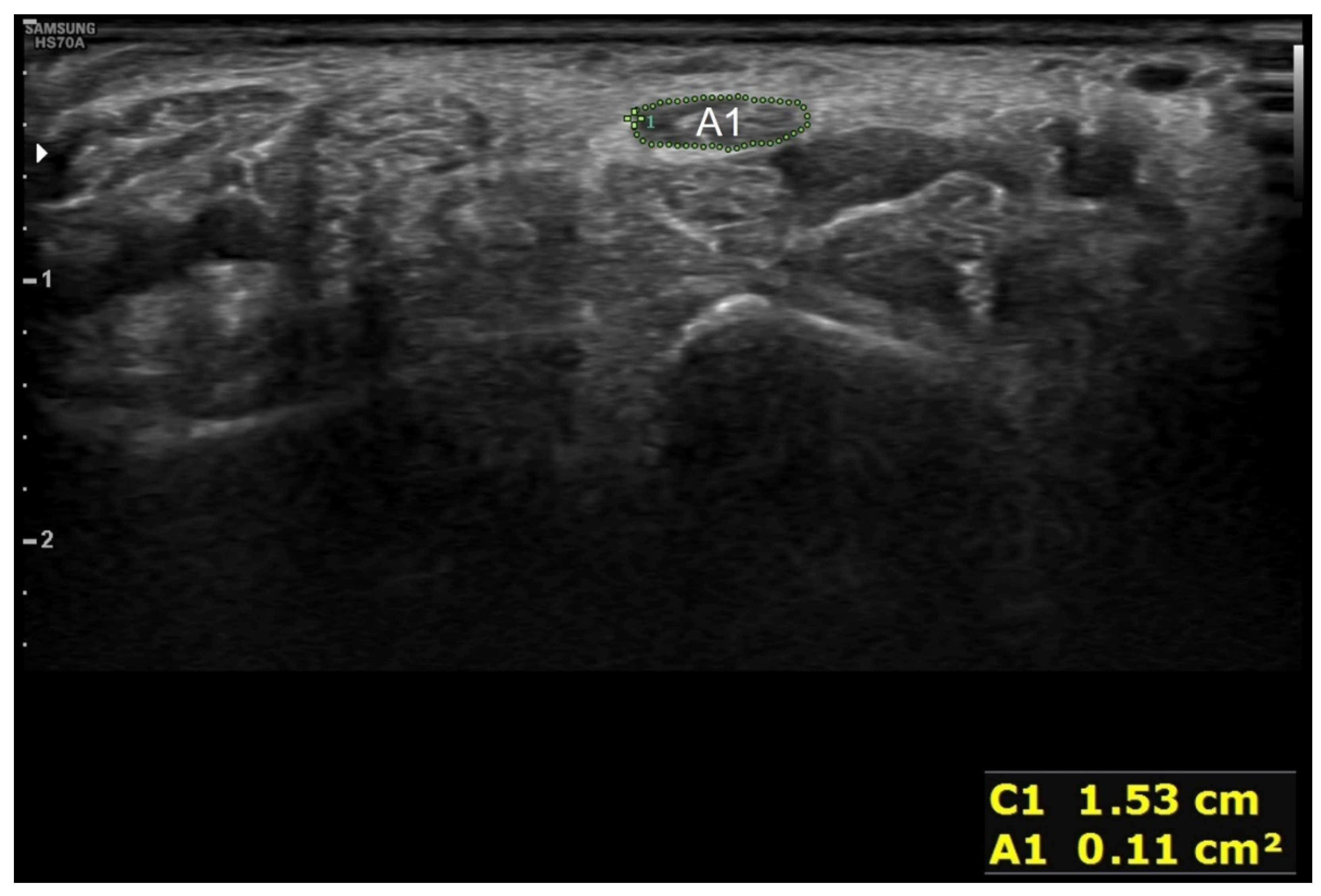 Diagnostics 12 01707 g003 Diagnostics 12 01707 g003