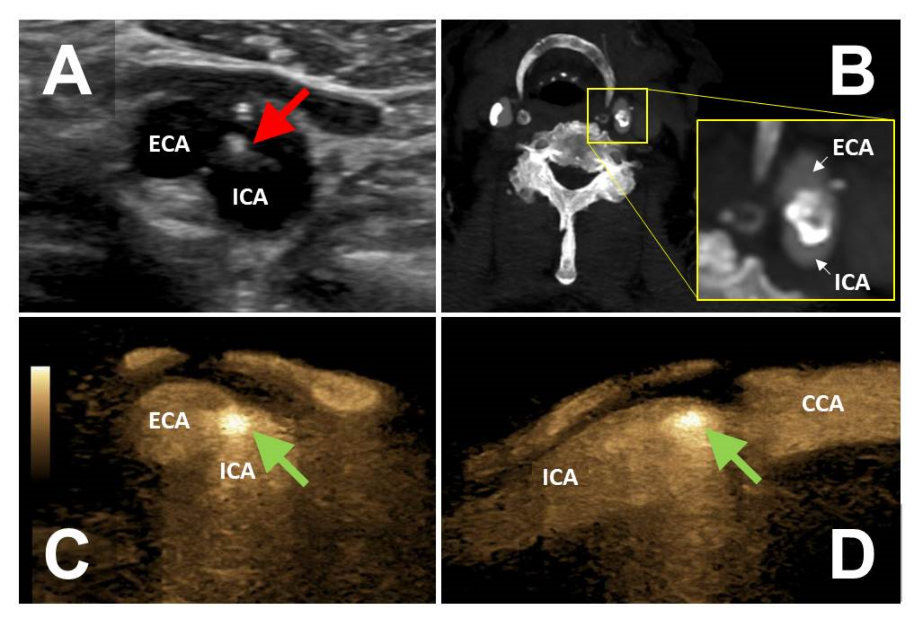 Diagnostics 12 01708 g003 550