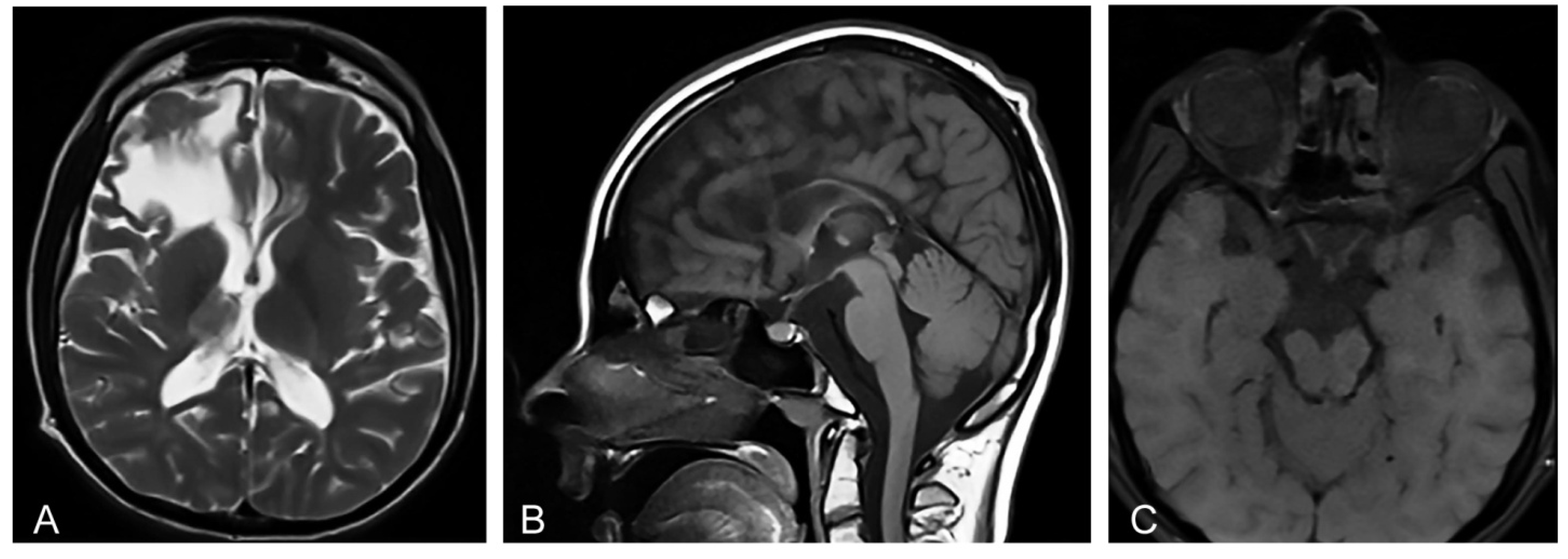 Diagnostics 12 01711 g001