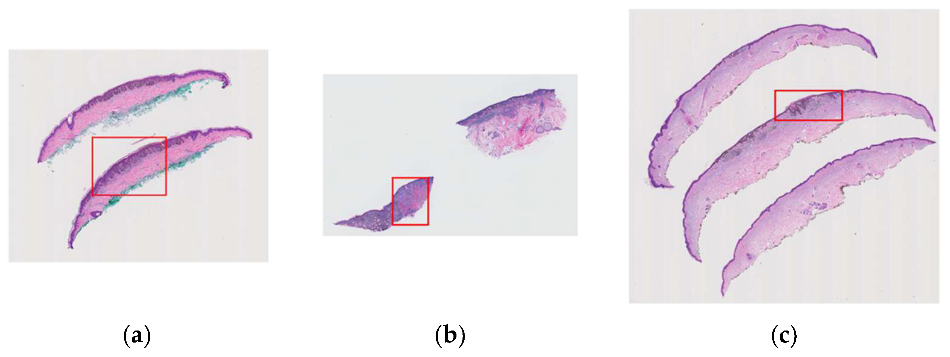 Diagnostics 12 01713 g002 550