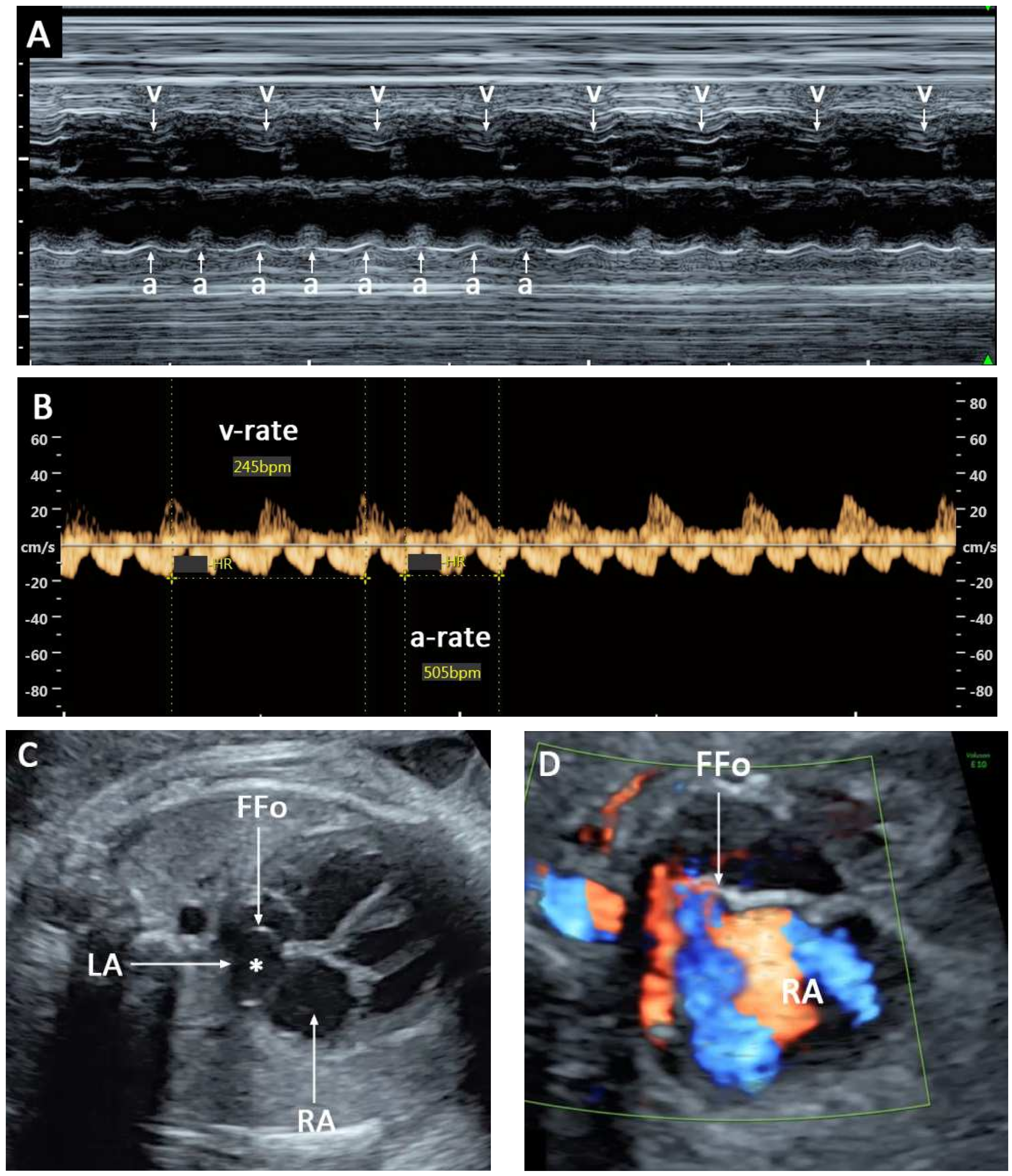 Diagnostics 12 01722 g001