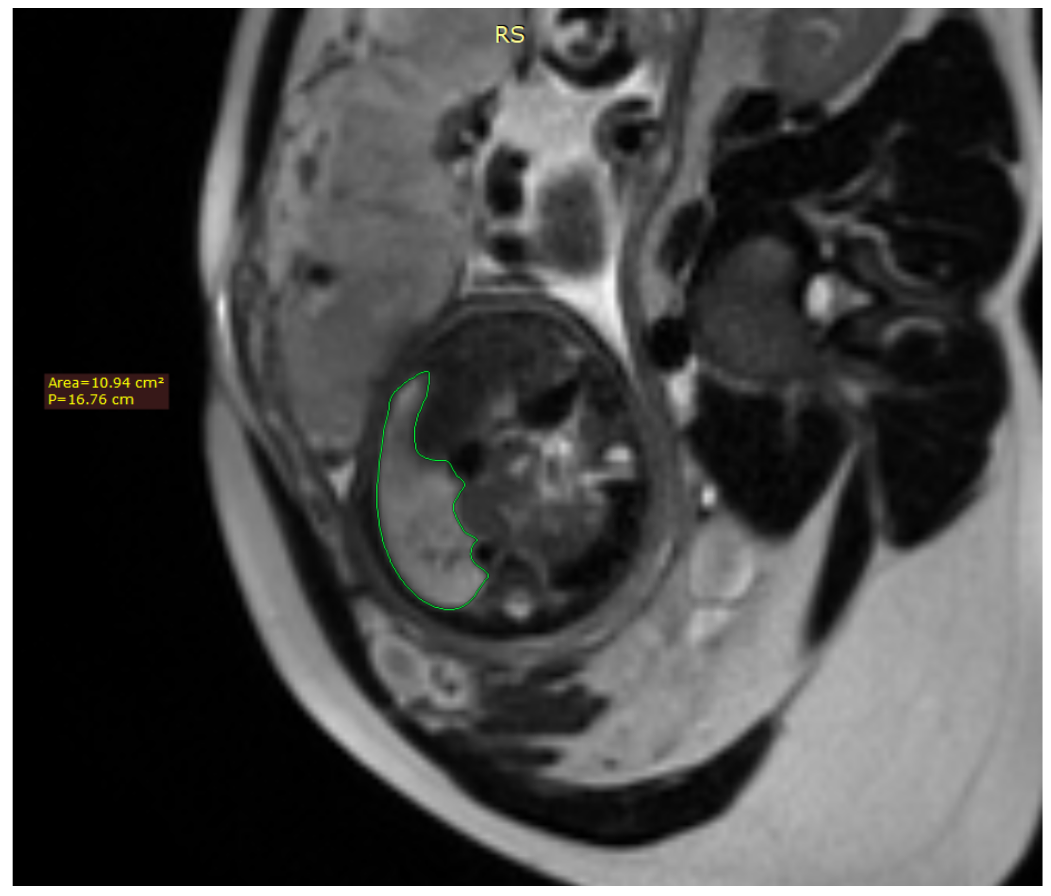 Diagnostics 12 01733 g001 550
