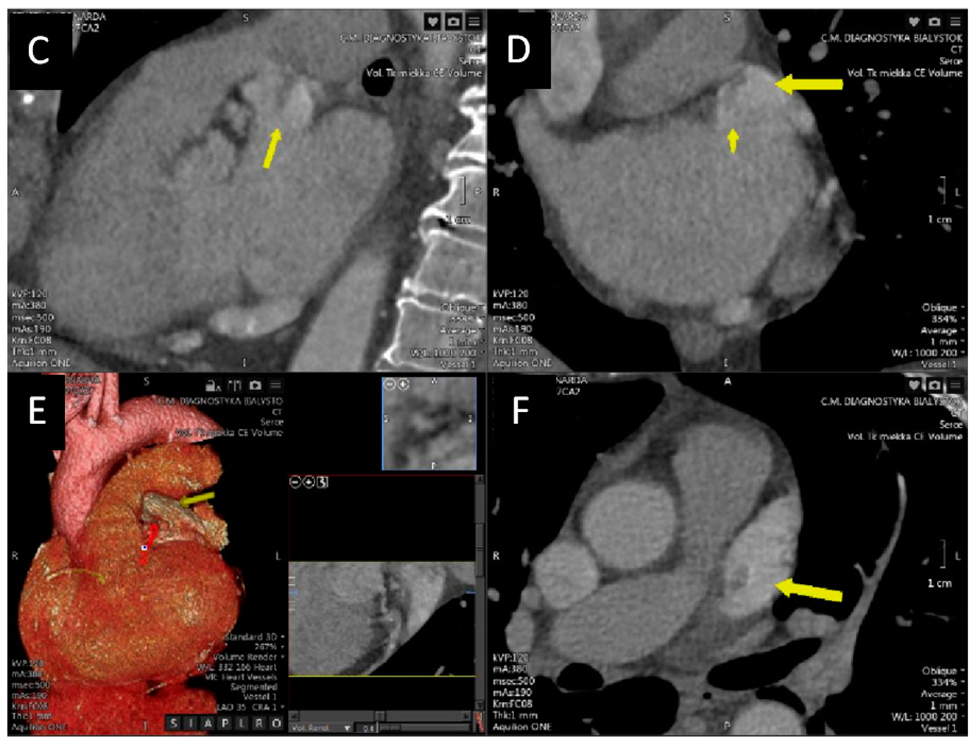 Diagnostics 12 01749 g001b