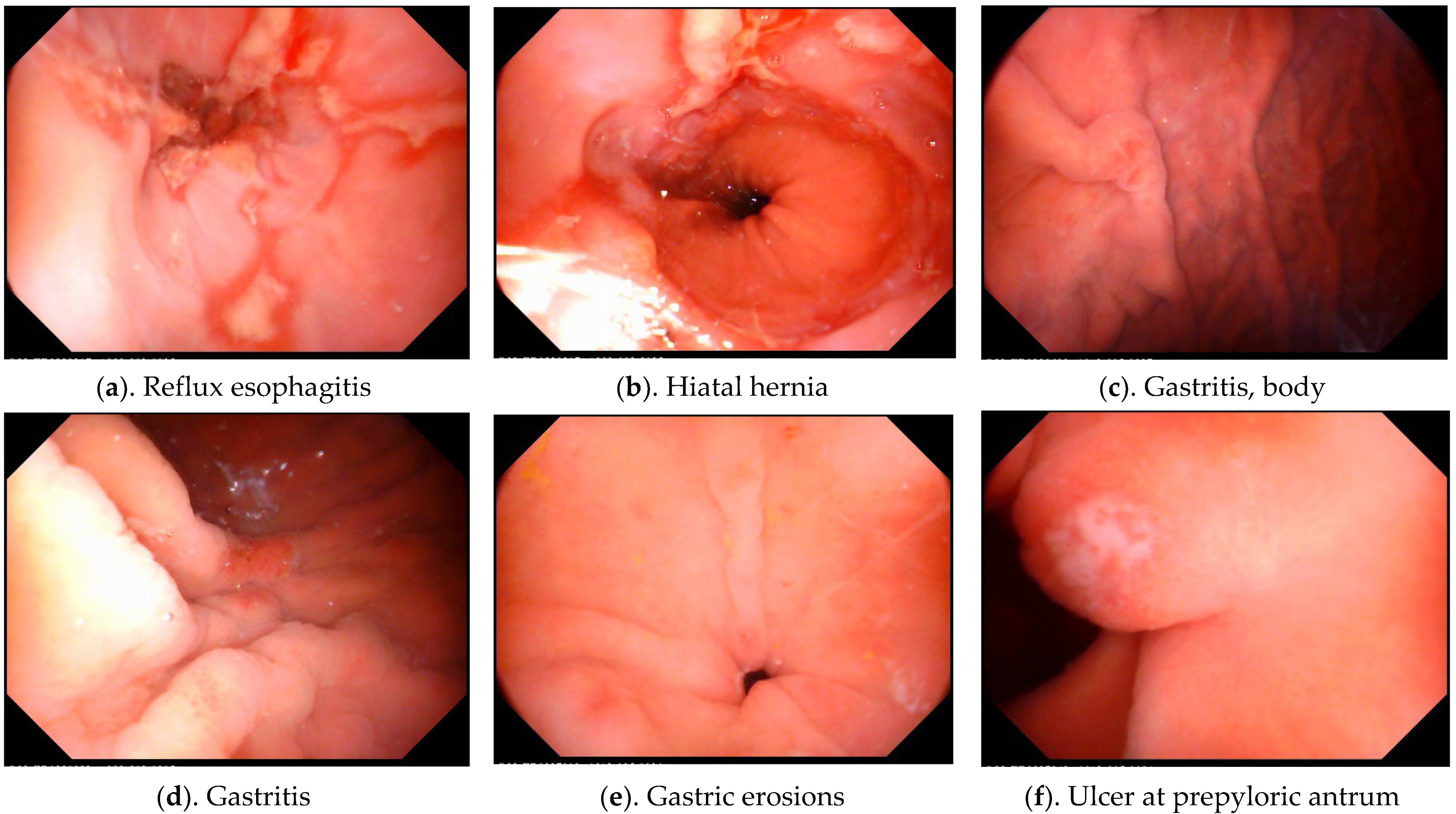 Diagnostics 12 01755 g001a