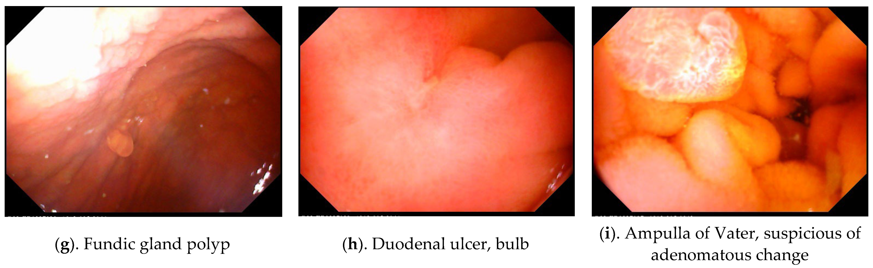 Diagnostics 12 01755 g001b