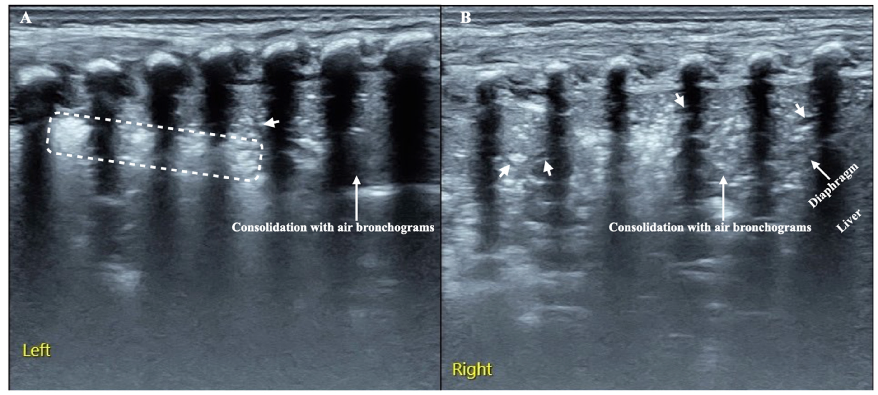 Diagnostics 12 01776 g002 550