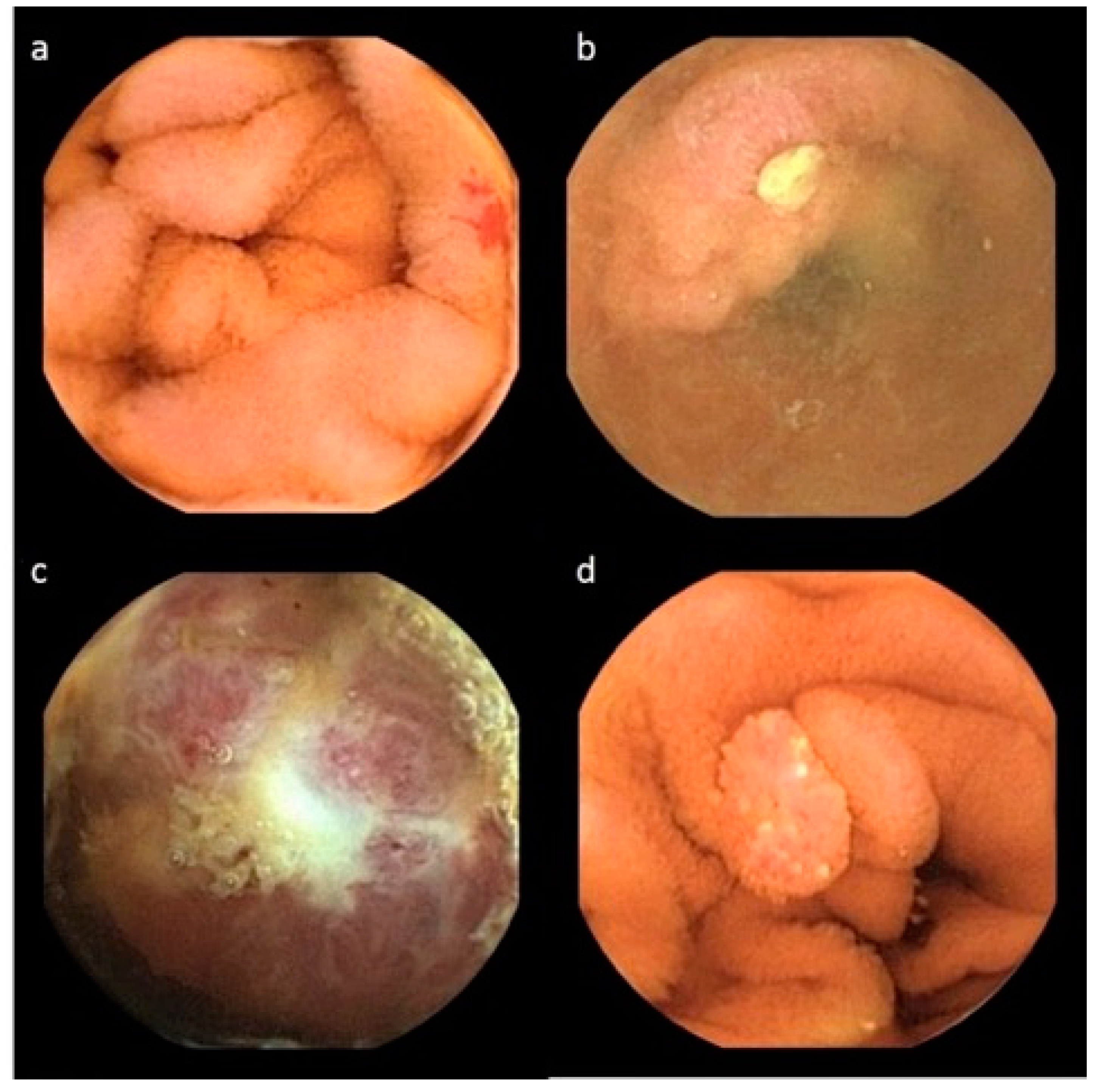 Diagnostics 12 01783 g002 550