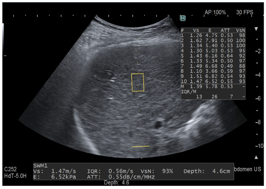 Diagnostics 12 01787 g001 550