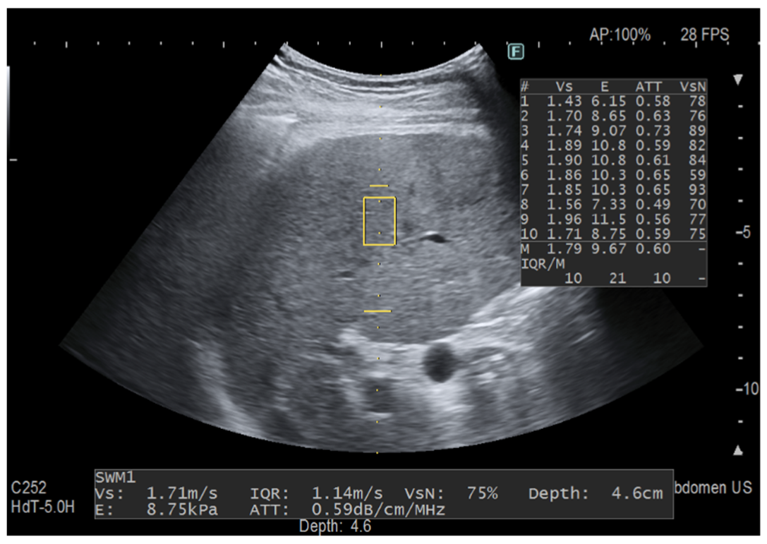 Diagnostics 12 01787 g002 550