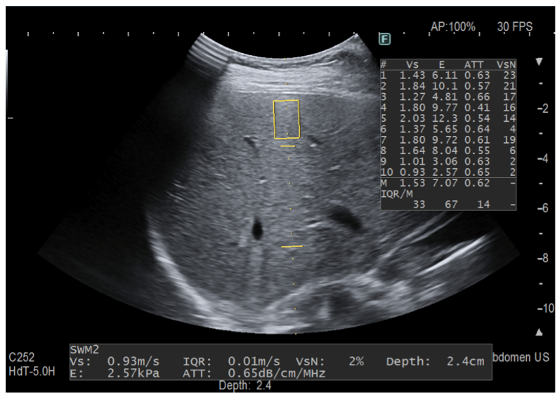 Diagnostics 12 01787 g003 550