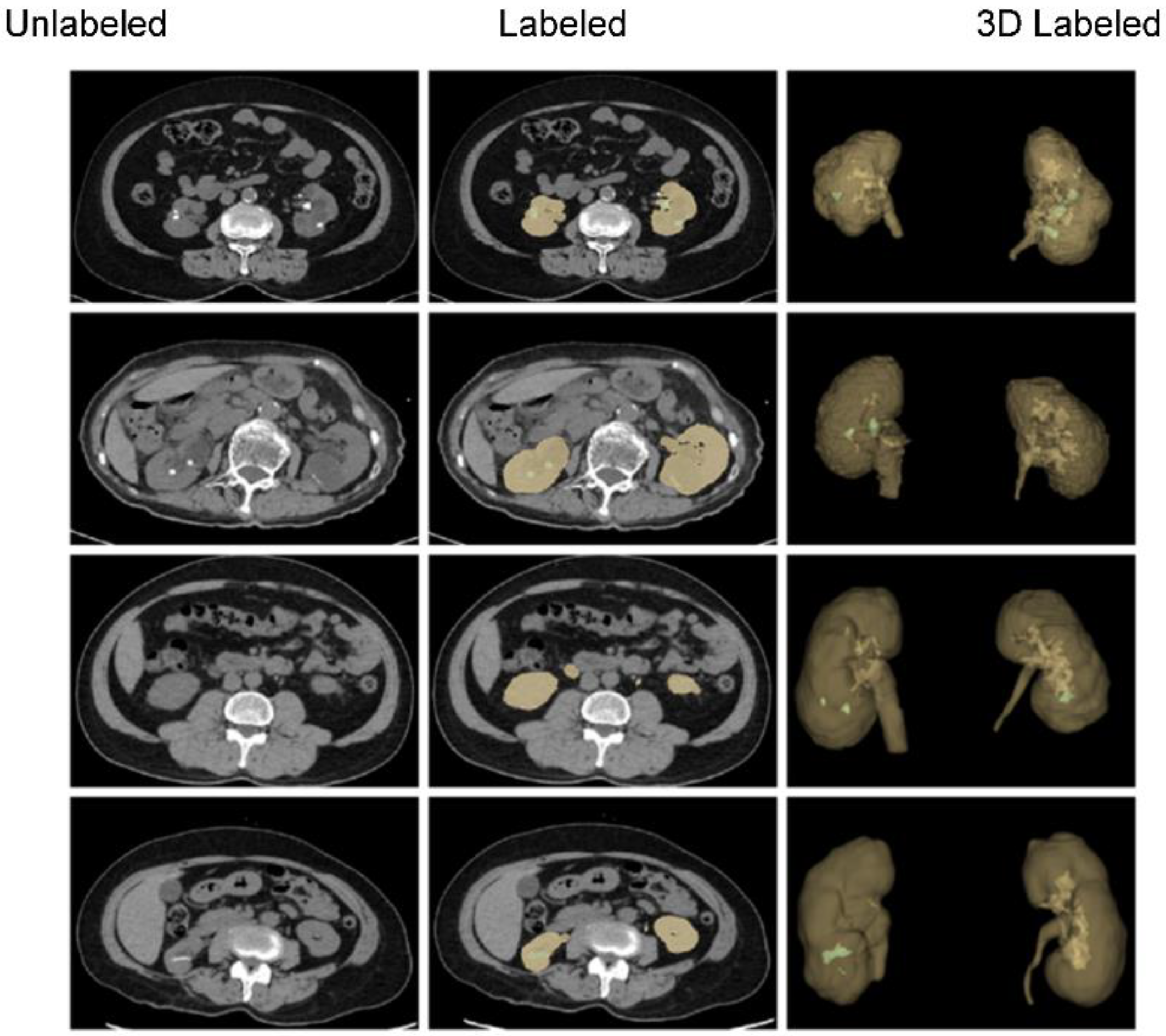 Diagnostics | Free Full-Text | Deep Segmentation Networks for stone crypto