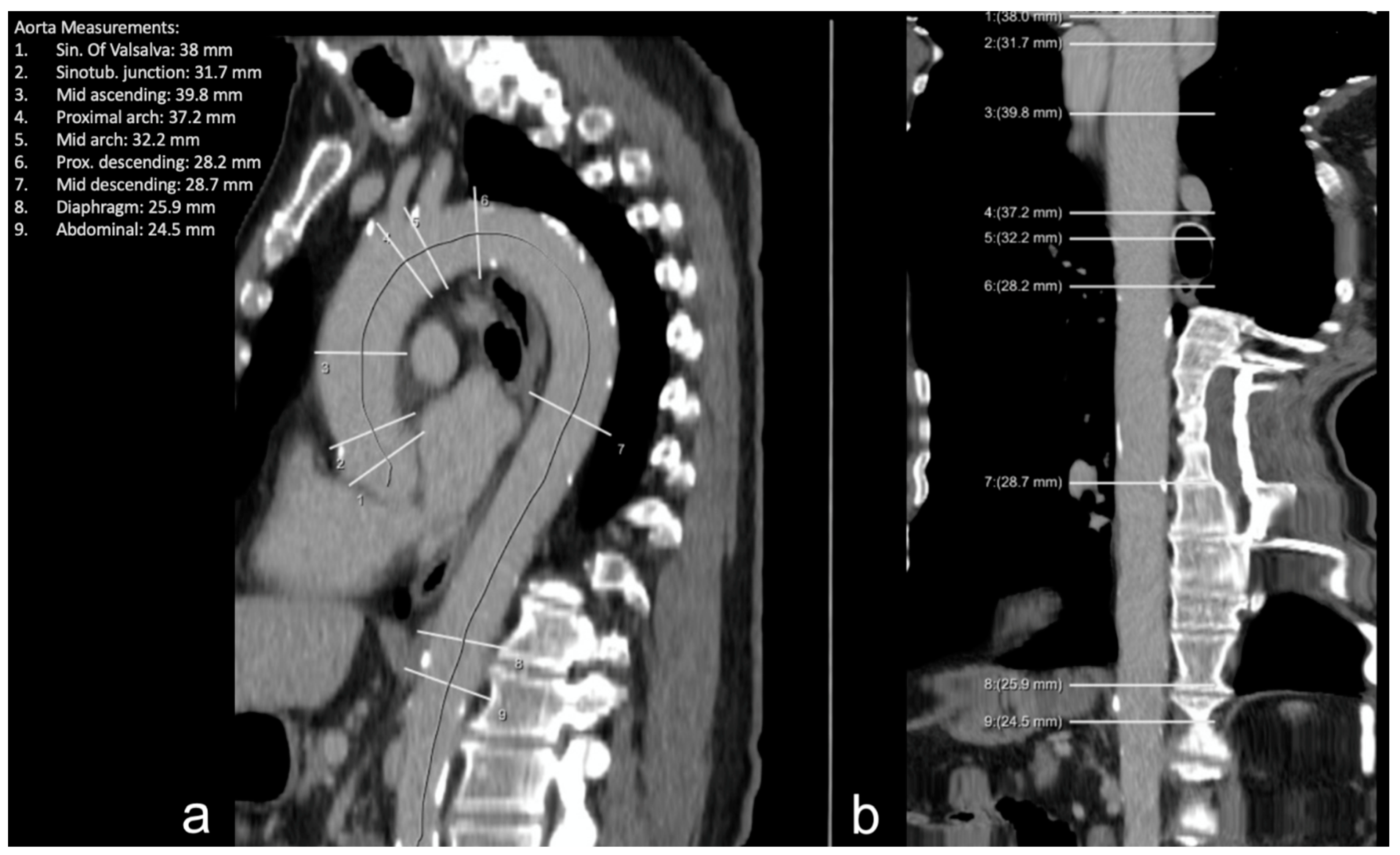 Diagnostics 12 01790 g003 550