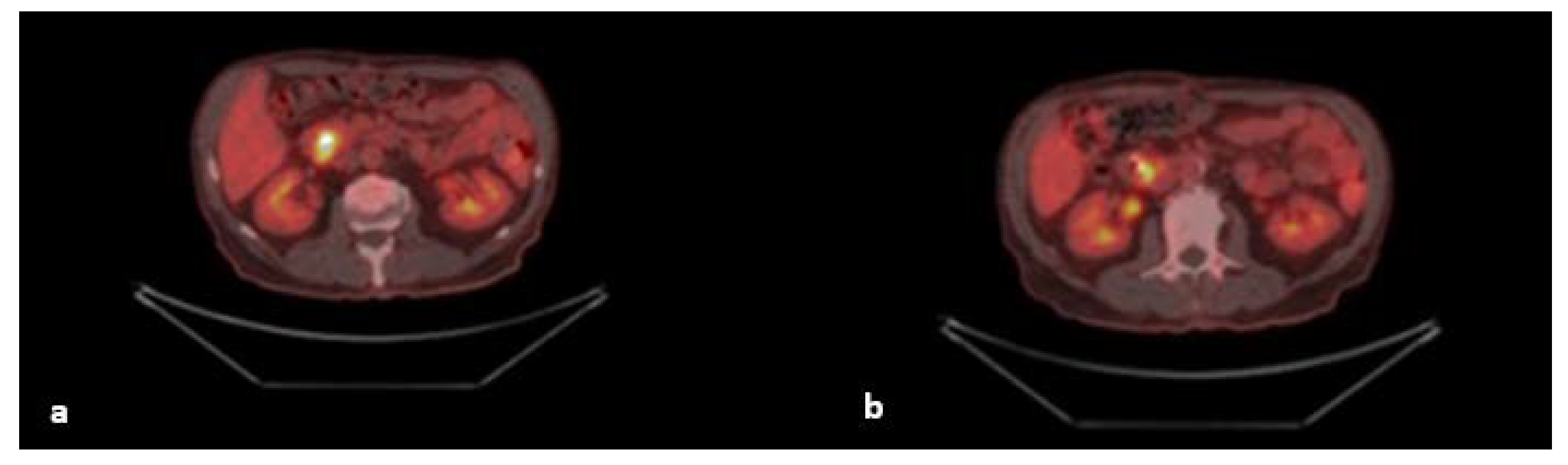 Diagnostics 12 01797 g002 Diagnostics 12 01797 g002