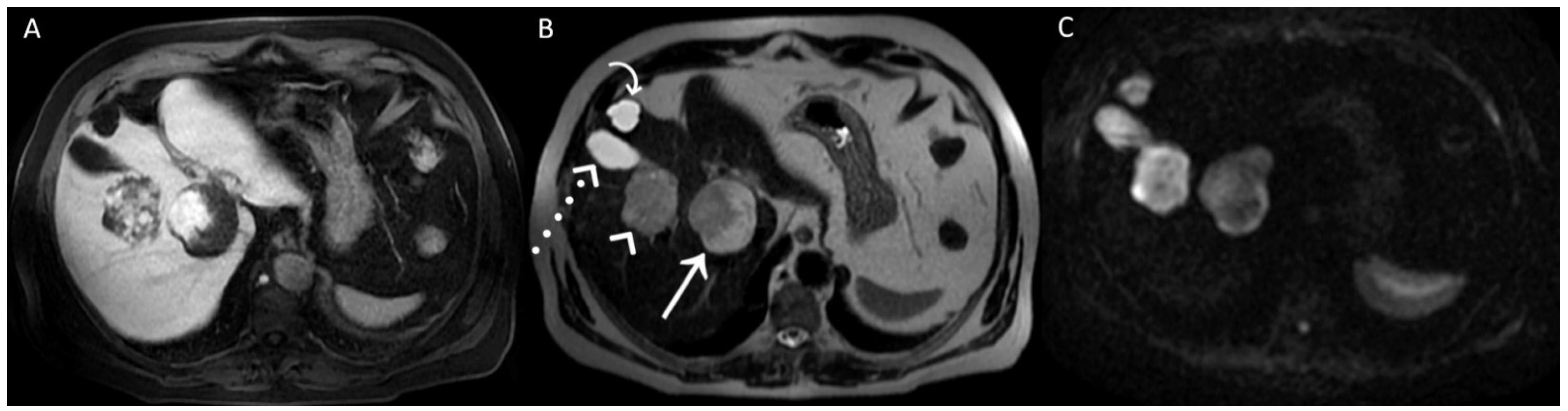 Diagnostics 12 01811 g003 550