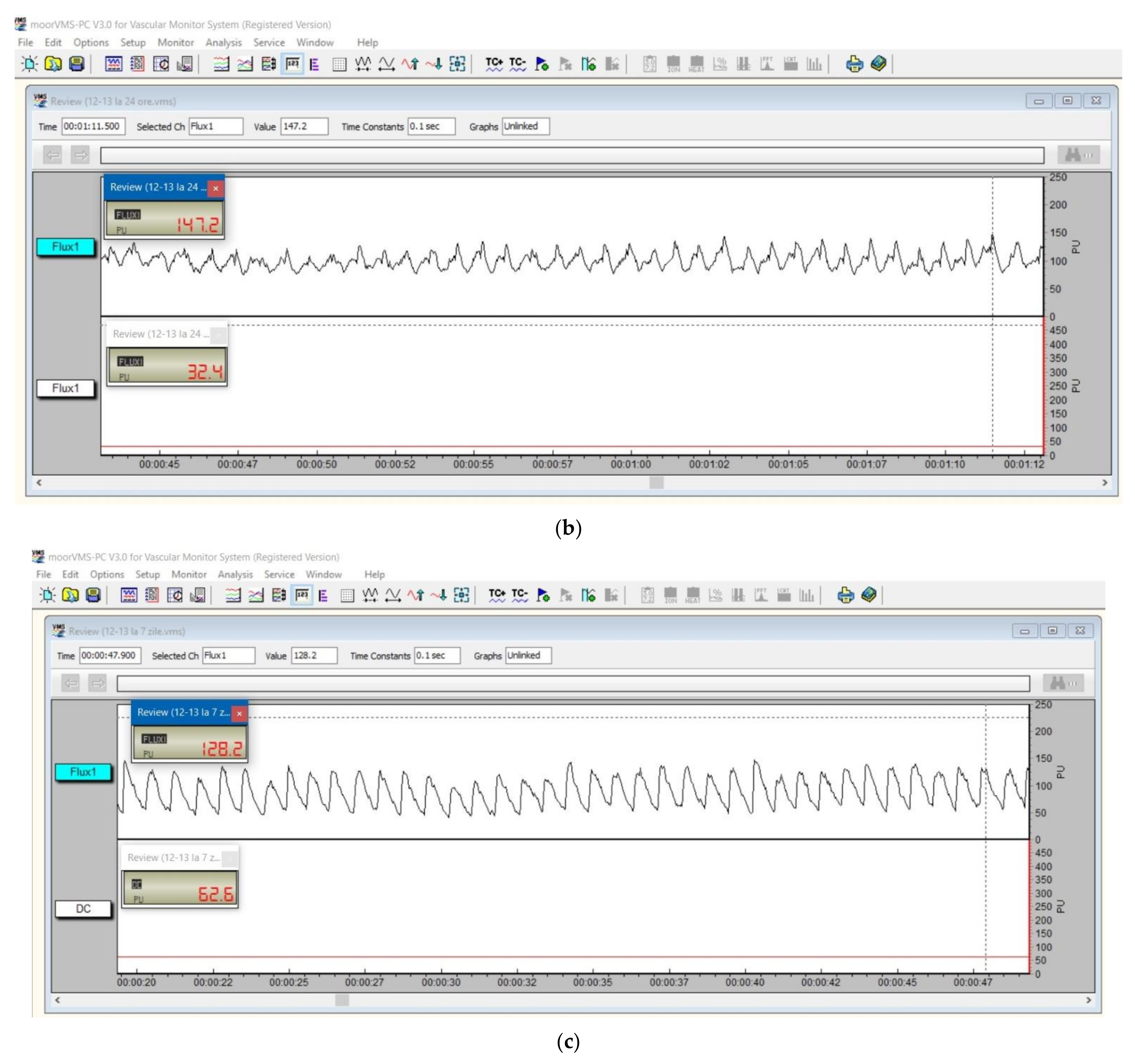Diagnostics 12 01830 g003b
