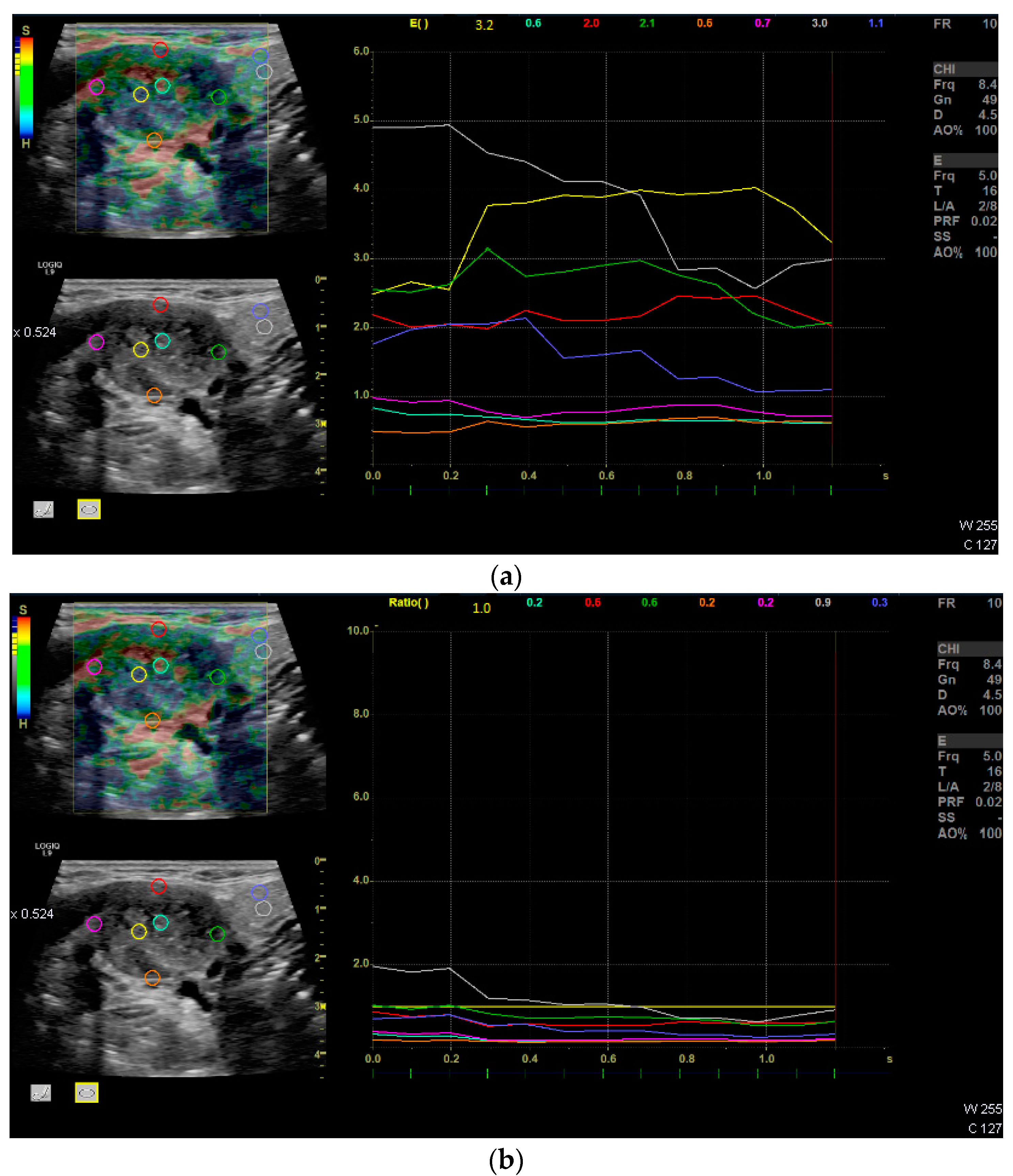 Diagnostics 12 01842 g003