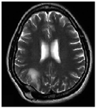 Diagnostics 12 01850 i002