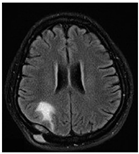 Diagnostics 12 01850 i004