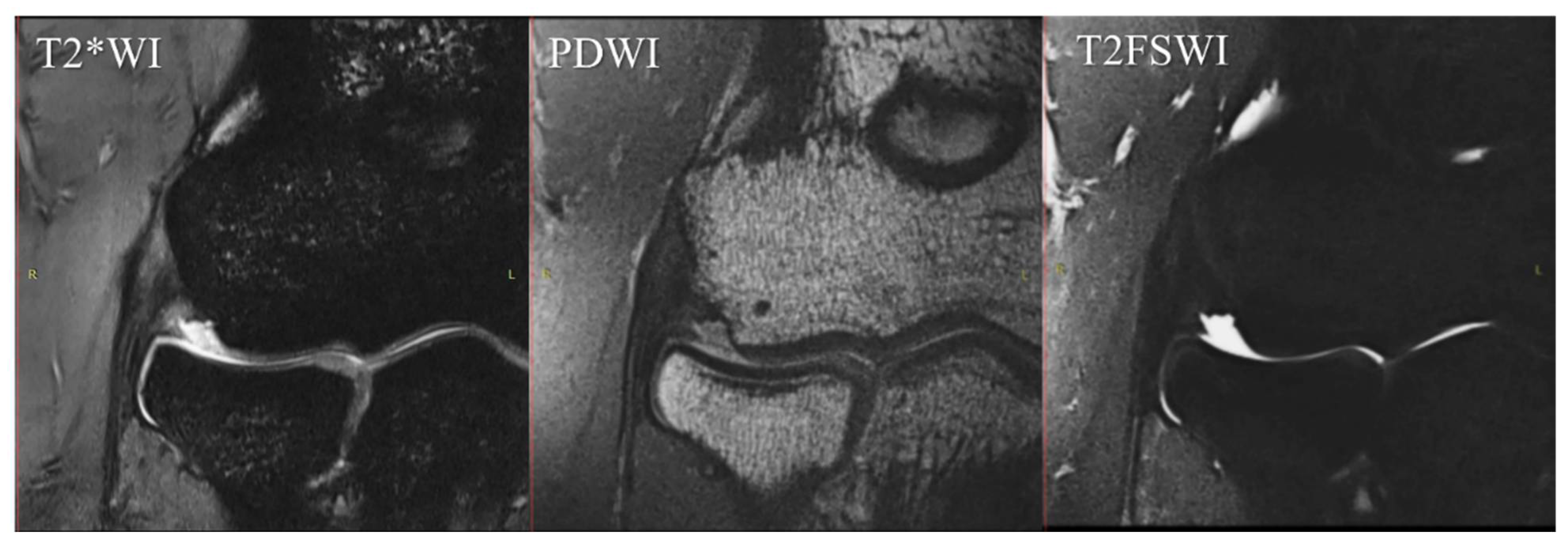 Diagnostics 12 01871 g003
