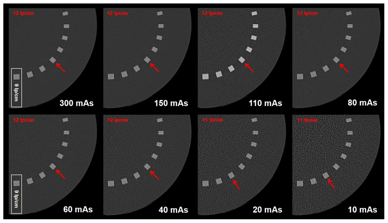 Diagnostics 12 01872 g004
