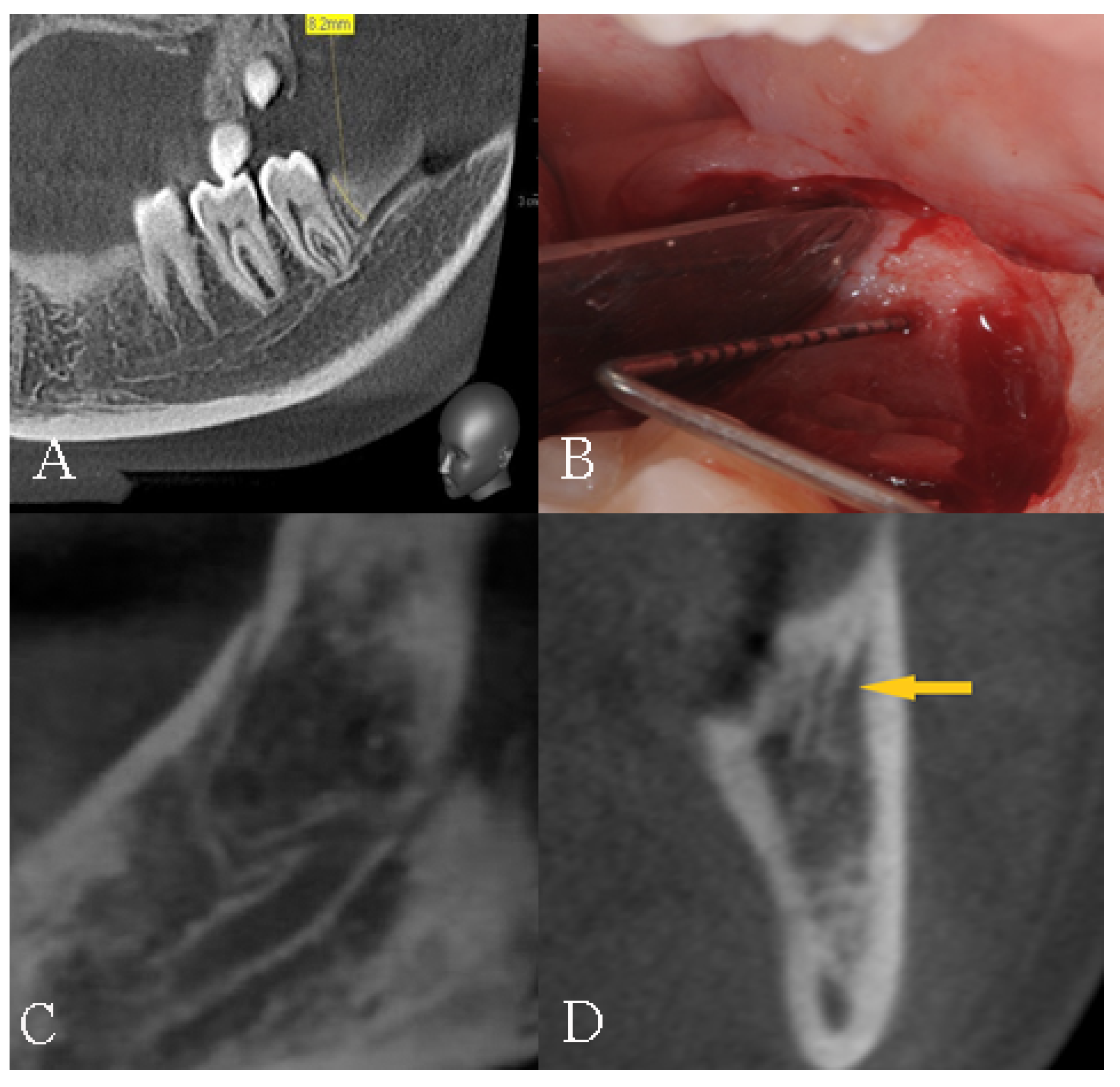 Diagnostics 12 01885 g005